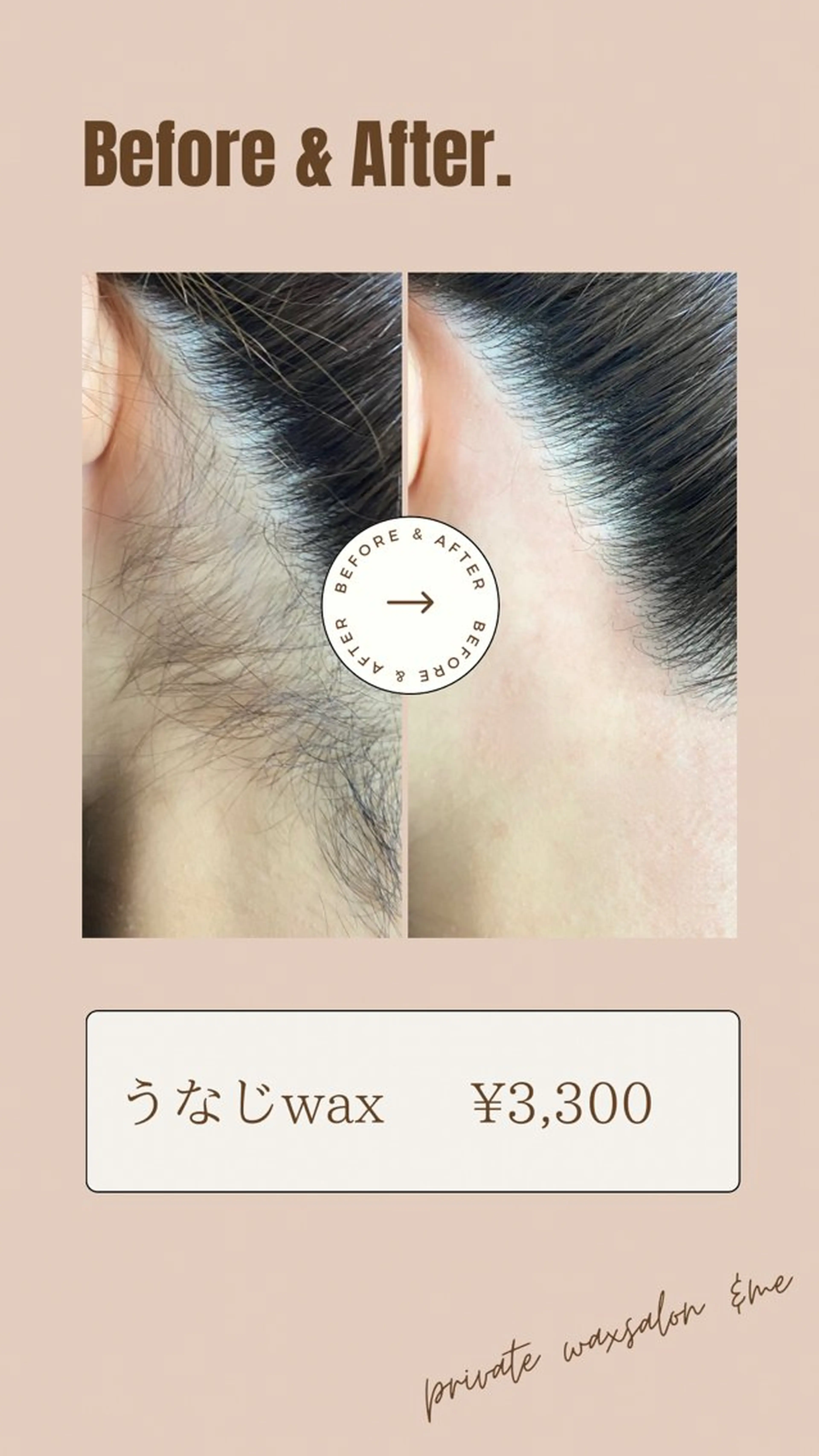 脱毛 &me ayakaのエステ・リラクイメージ