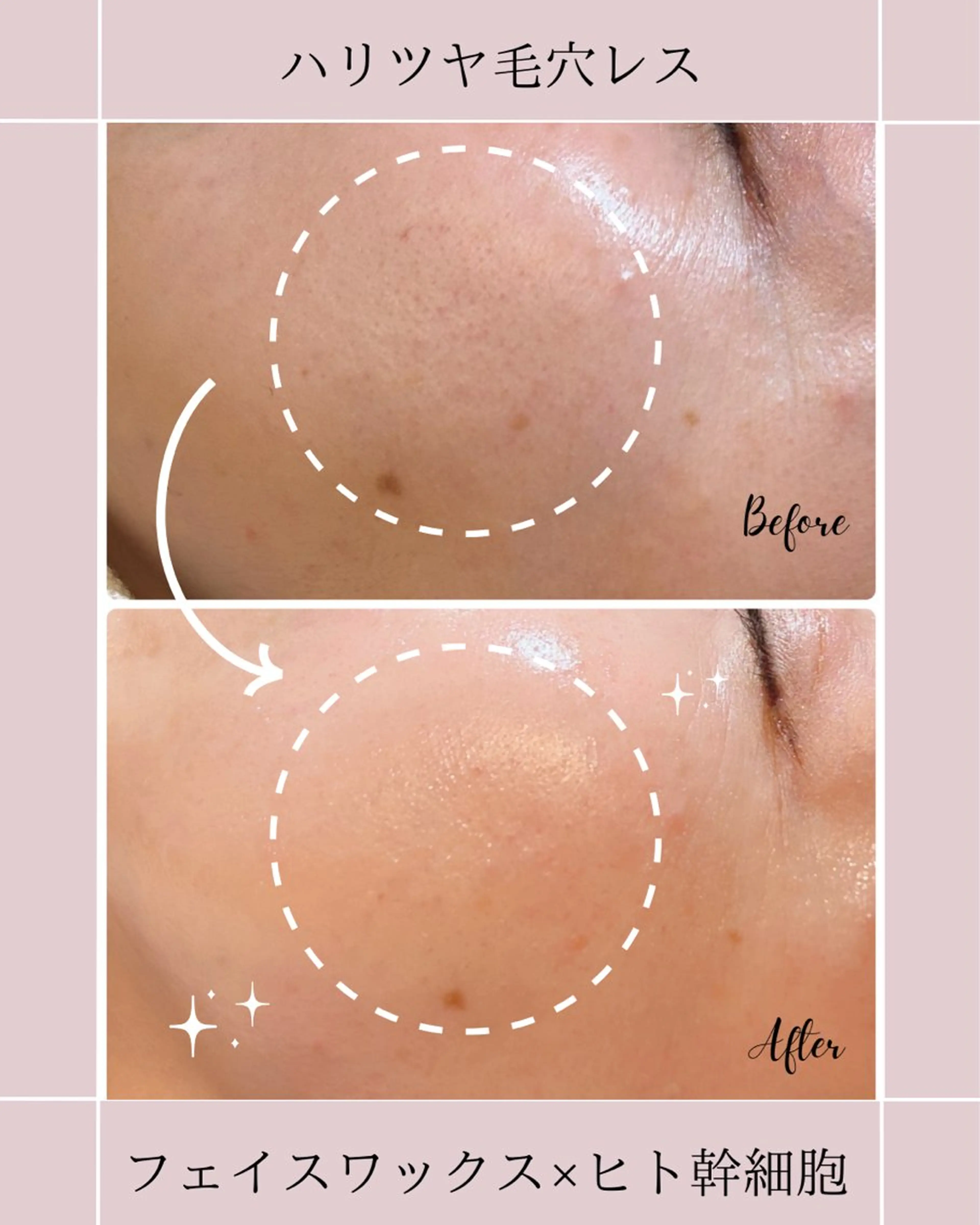 Detox Salon〜Lani Blue〜所属・土田 遥菜のエステ・リラクイメージ