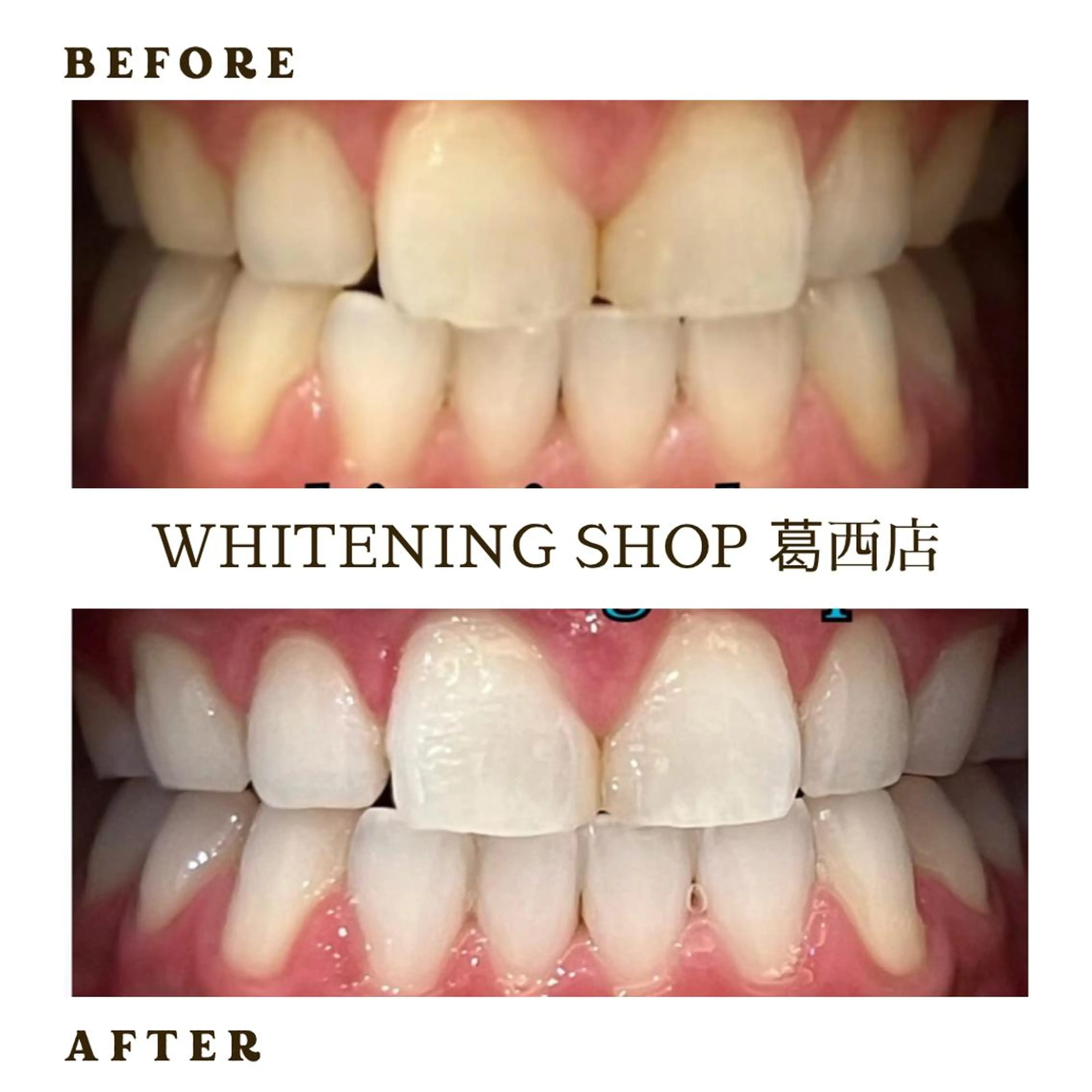 メンズ その他 ホワイトニング ショップ葛西店のその他イメージ