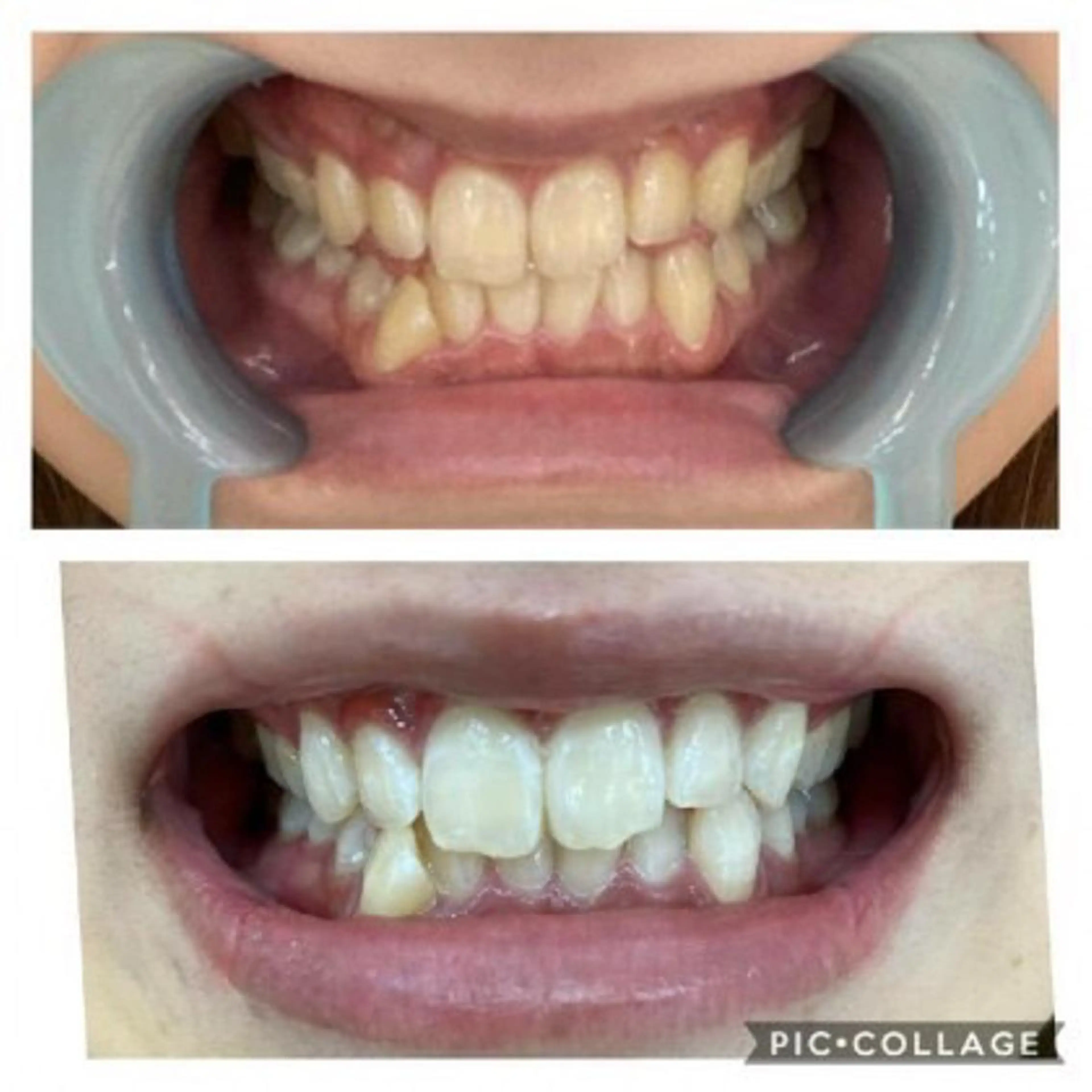 M渋谷 ホワイトニングのエステ・リラクイメージ