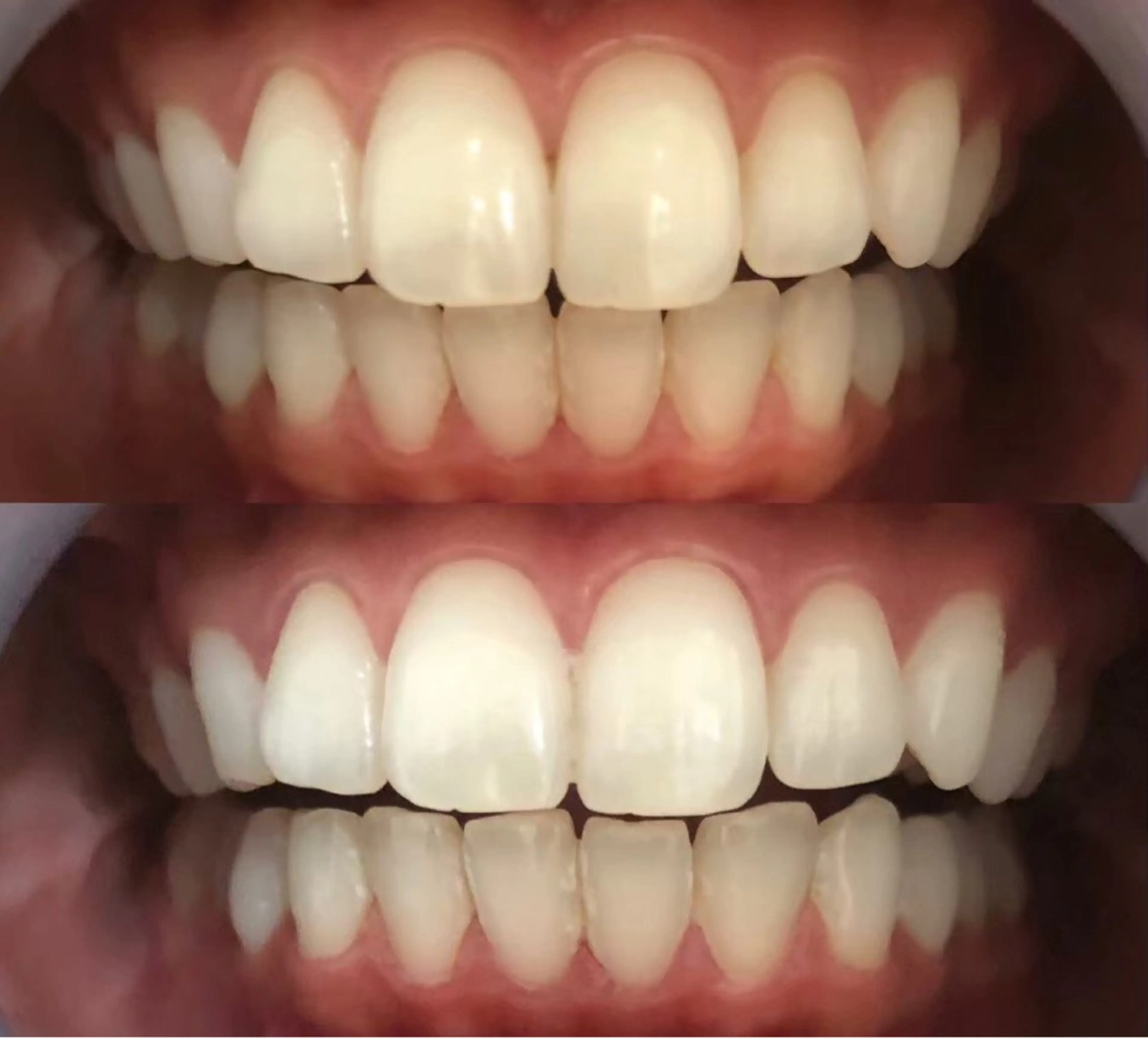 エステ リラク LBSホワイトニング 🌐 上野店公式のエステ・リラクイメージ