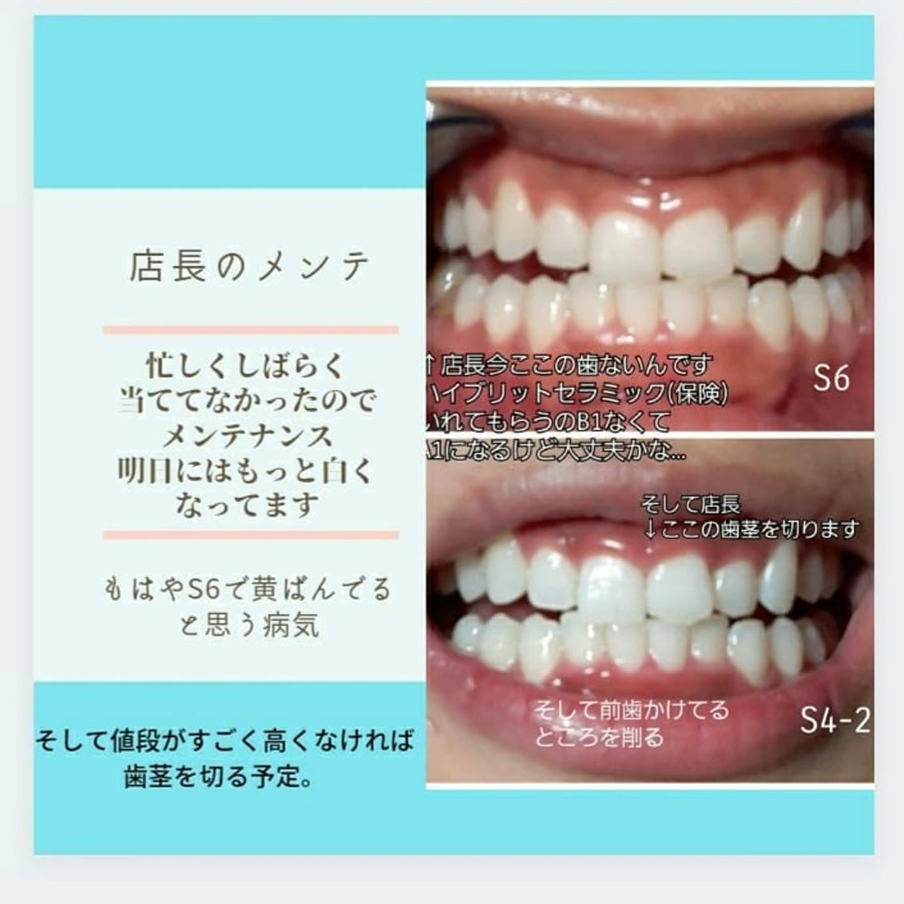 【矯正割】矯正頑張っている方!頑張った方!メンズも🆗‼️店長も頑張りました!30分2,470円🦷‼️の写真