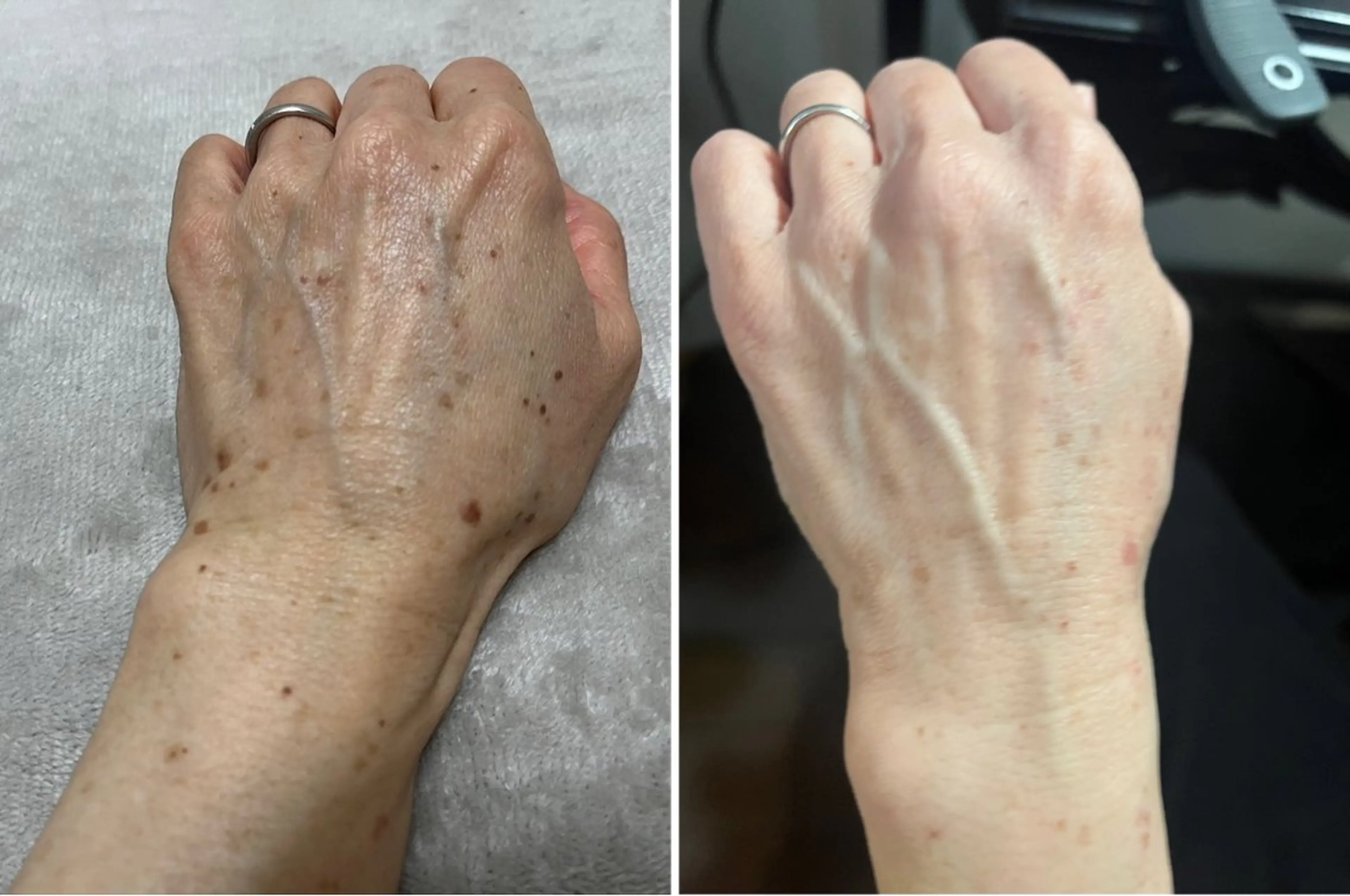 エステ リラク 小川 縁のエステ・リラクイメージ