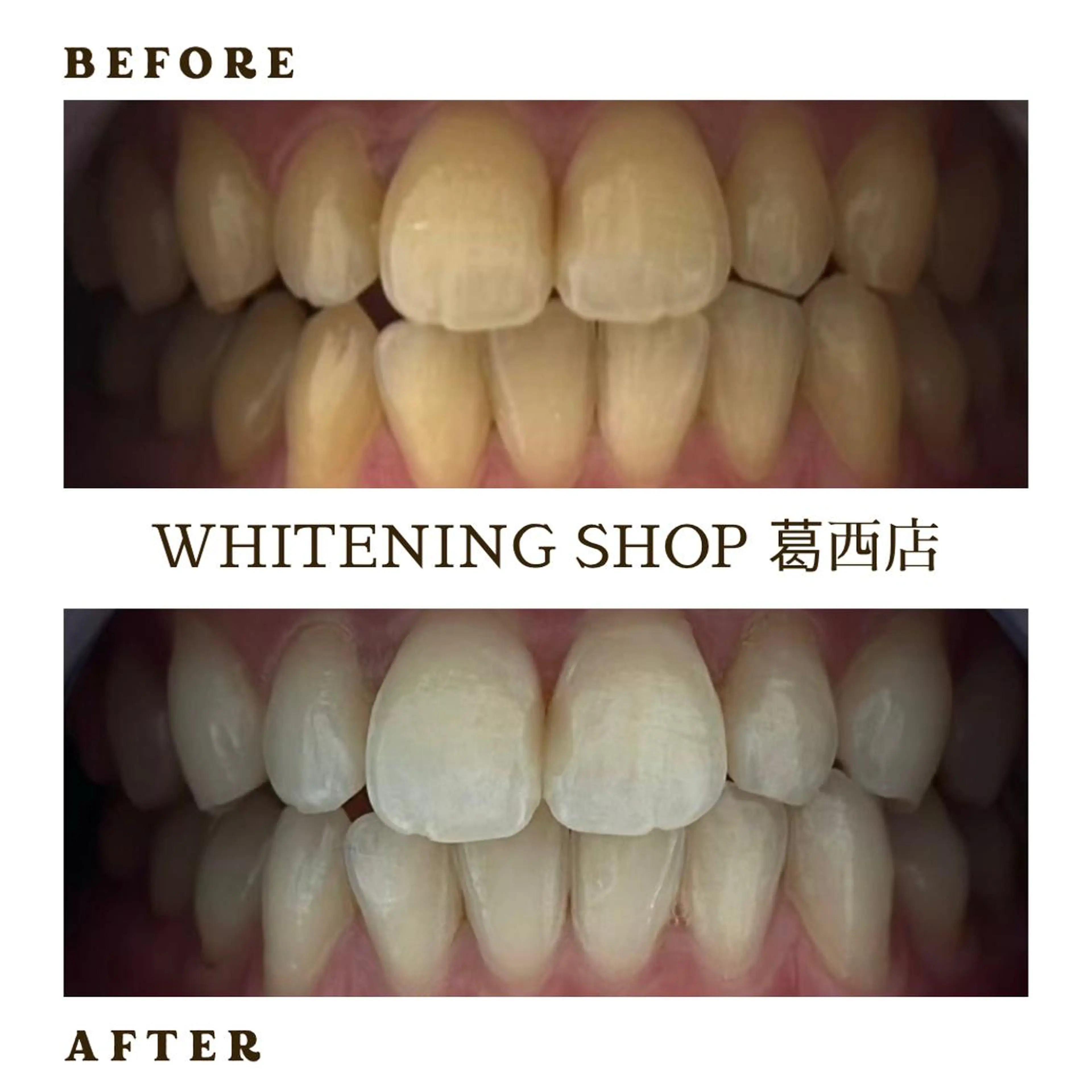 メンズ その他 ホワイトニング ショップ葛西店のその他イメージ