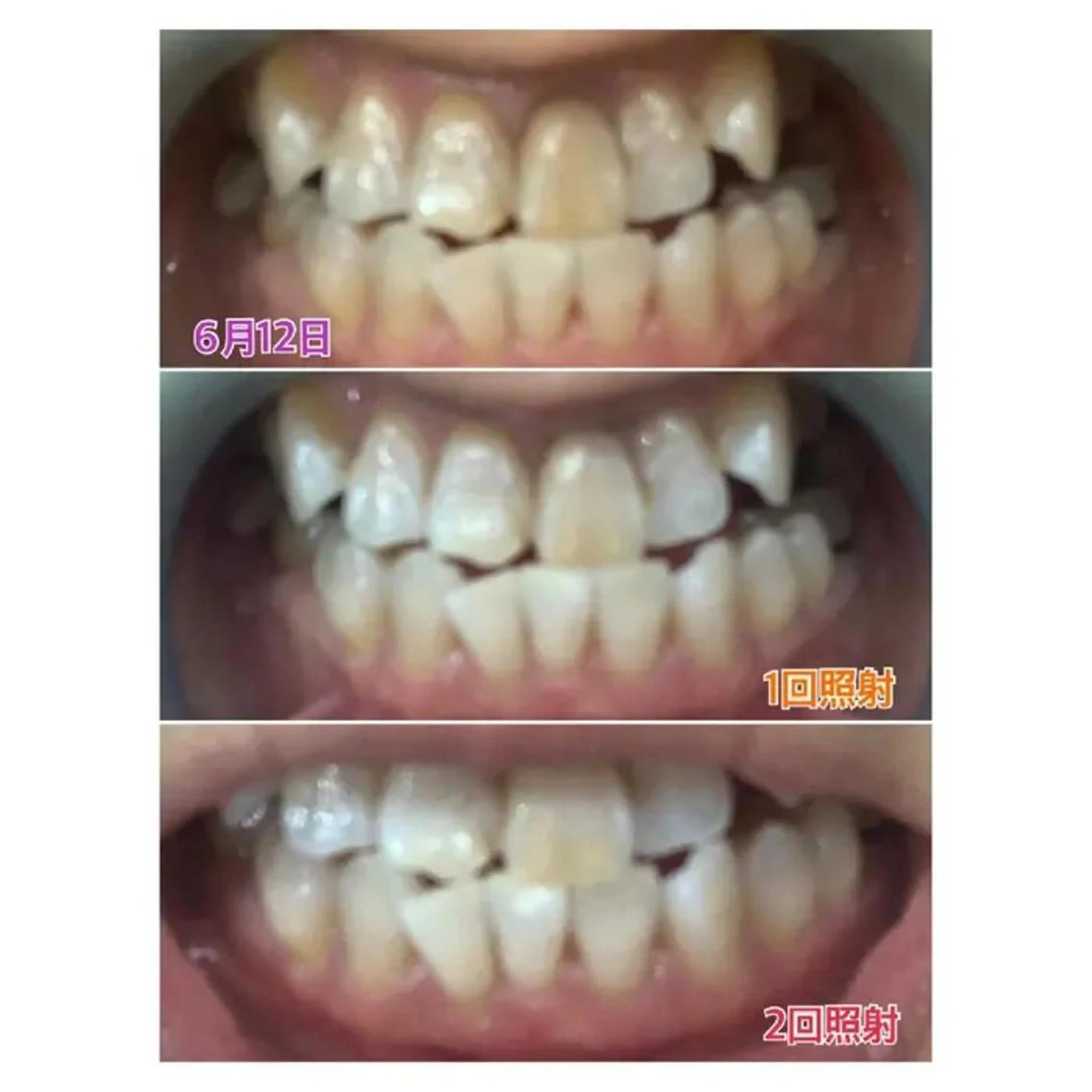 M渋谷 ホワイトニングのエステ・リラクイメージ