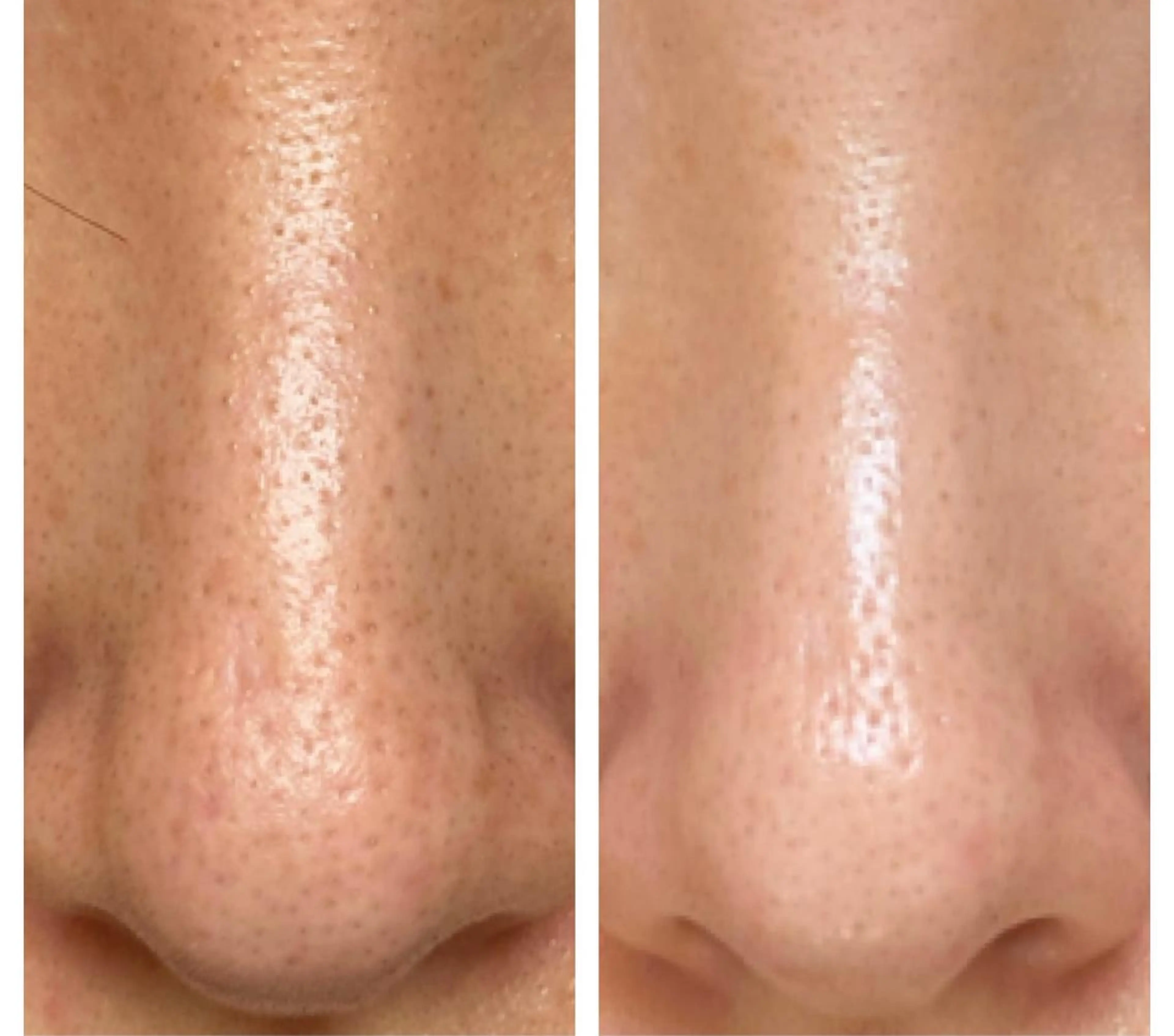 NORI @myuの眉毛・アイブロウイメージ