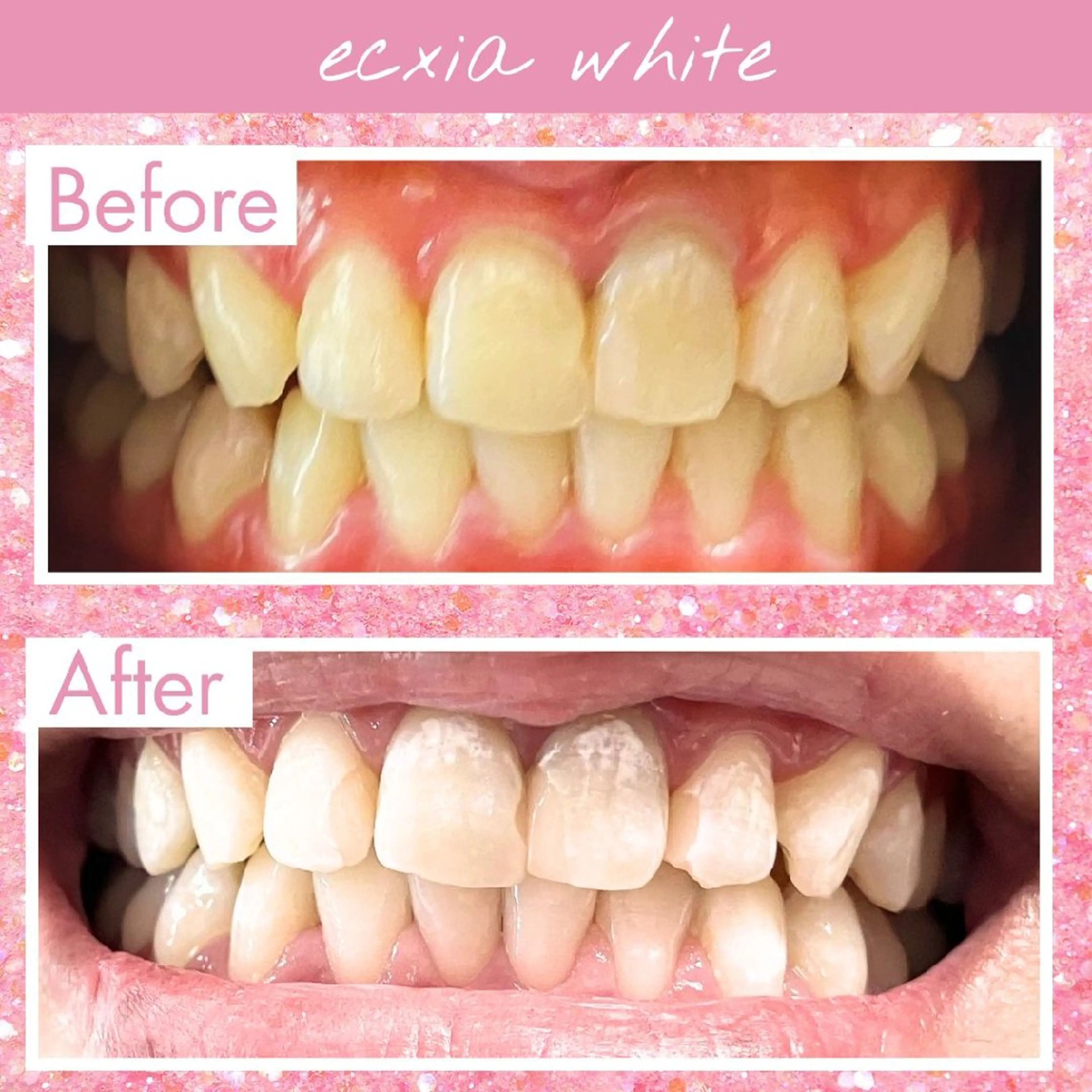 セルフホワイトニングエクシアホワイト草加店所属・セルフホワイトニング エクシア草加店のその他イメージ