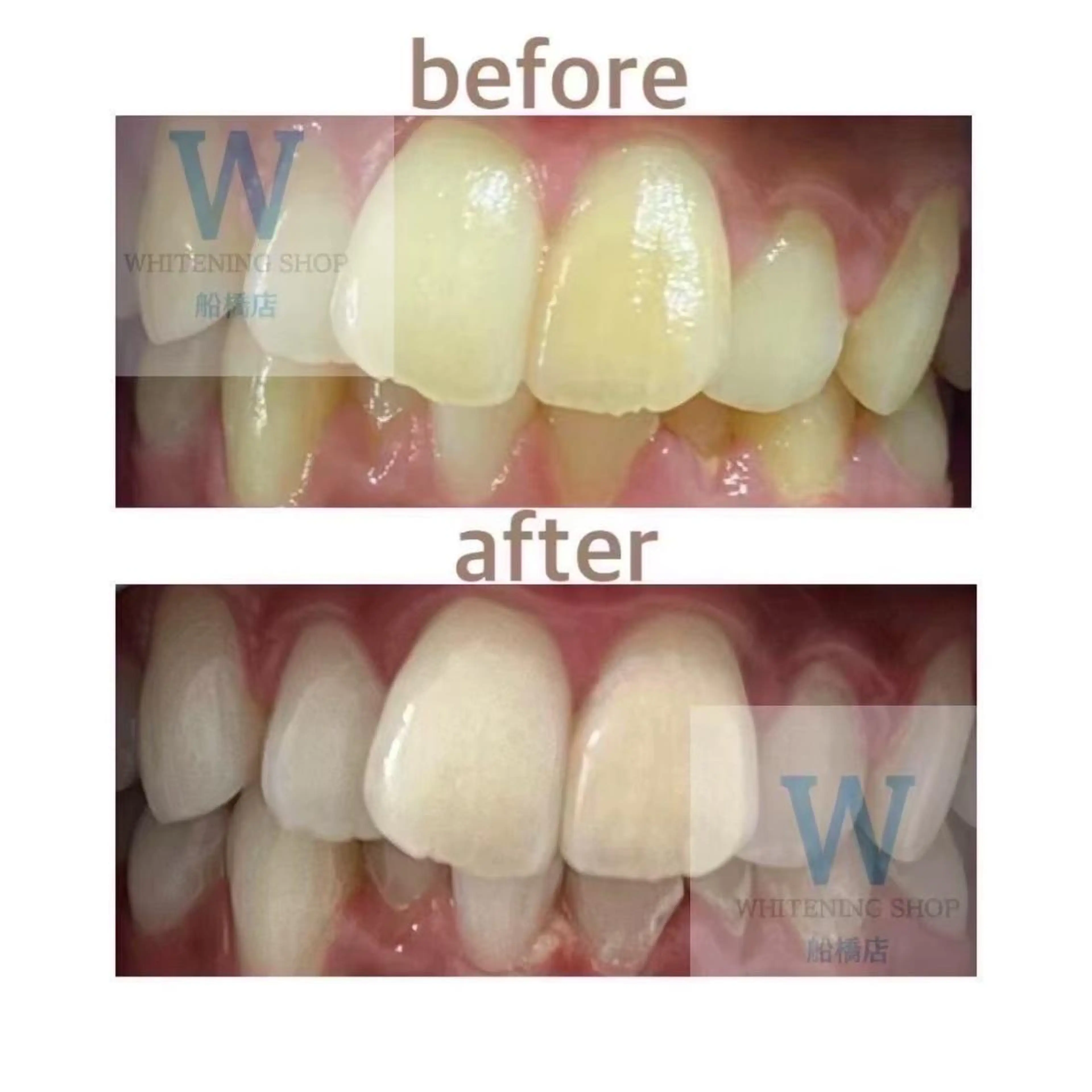 エステ リラク ホワイトニング ショップ船橋２号店のエステ・リラクイメージ