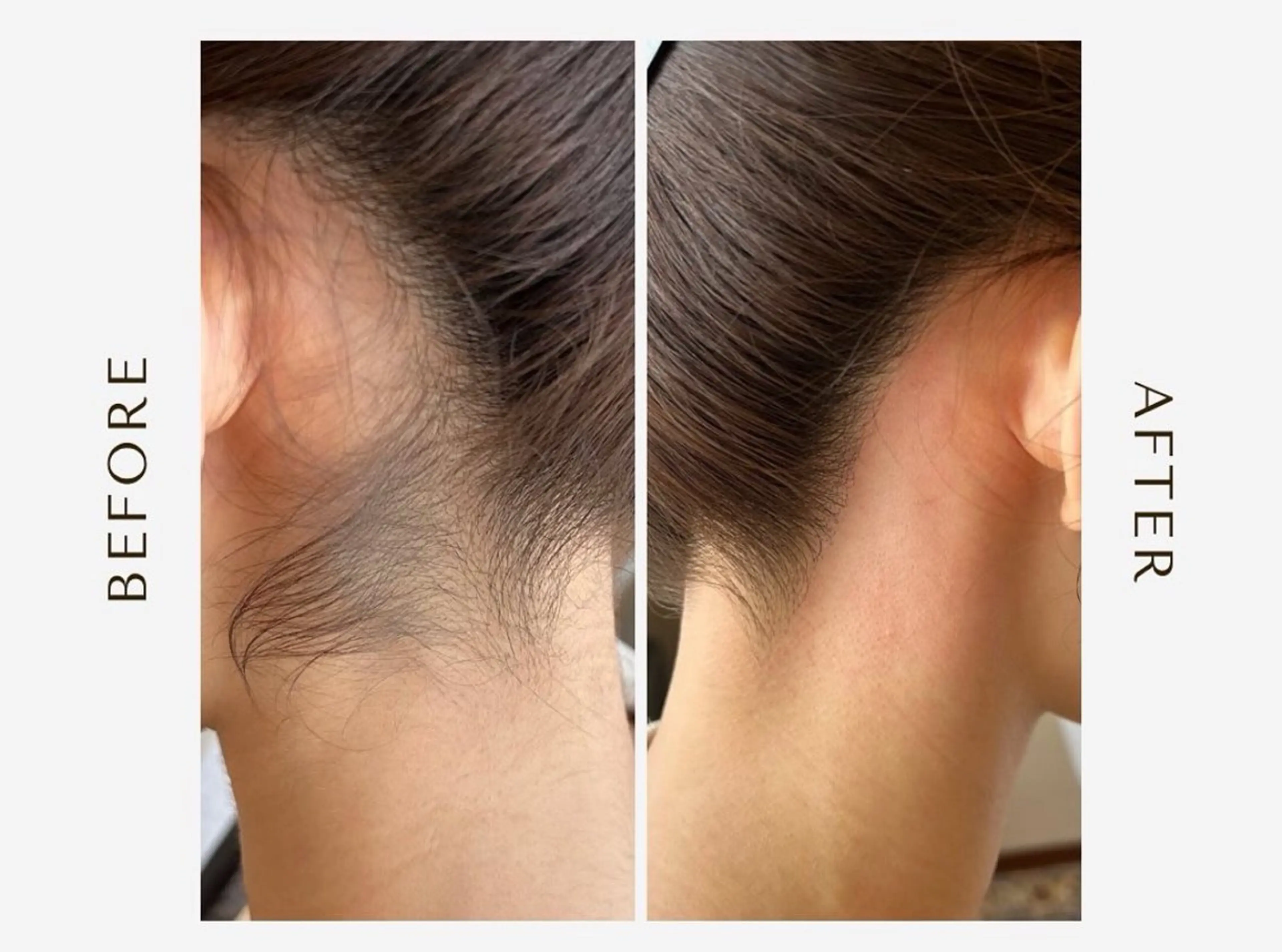 脱毛 RILsalon 脱毛/フェイシャルのエステ・リラクイメージ