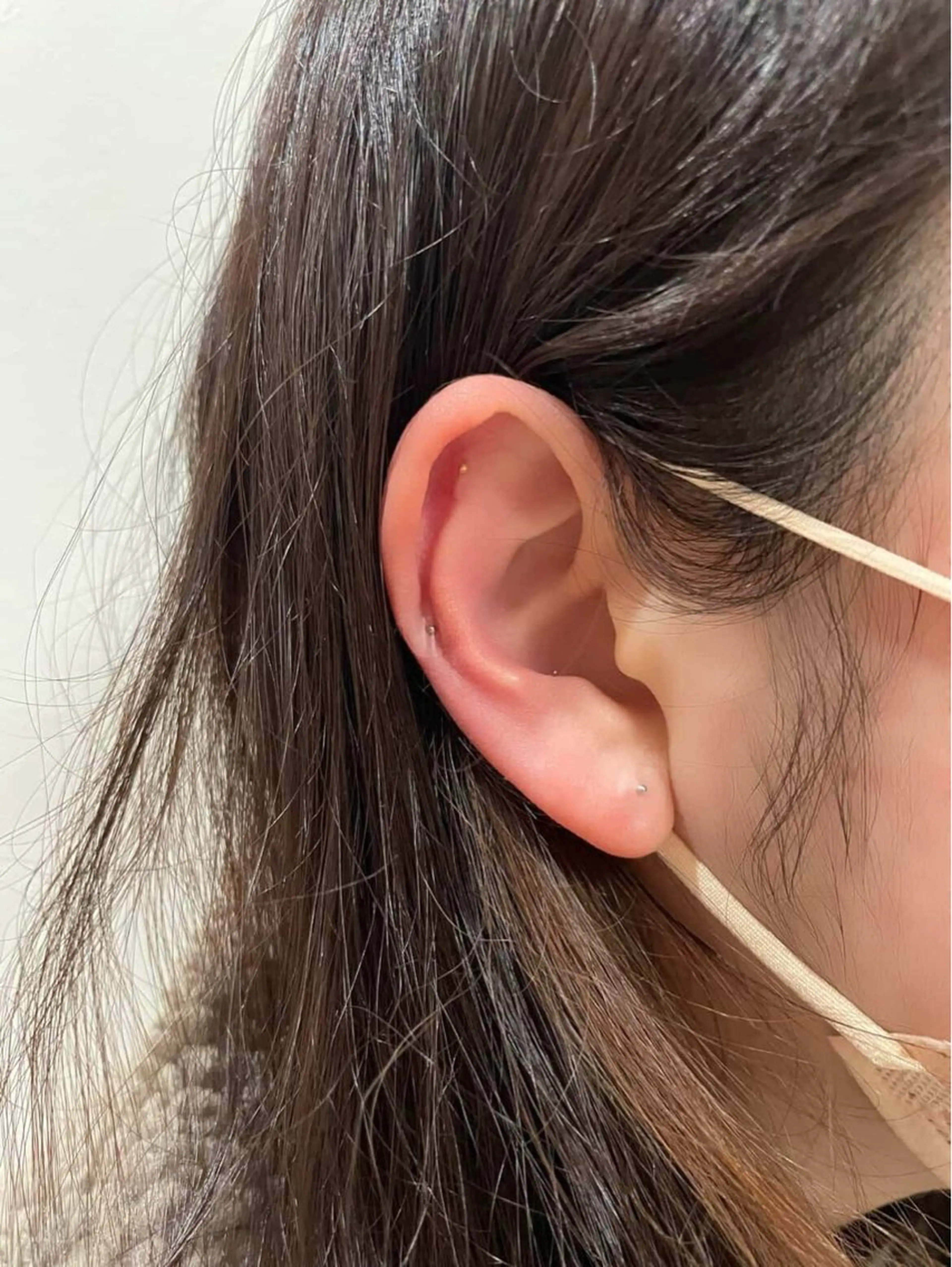 恵比寿ホワイトニング ホワイトハーツのその他イメージ