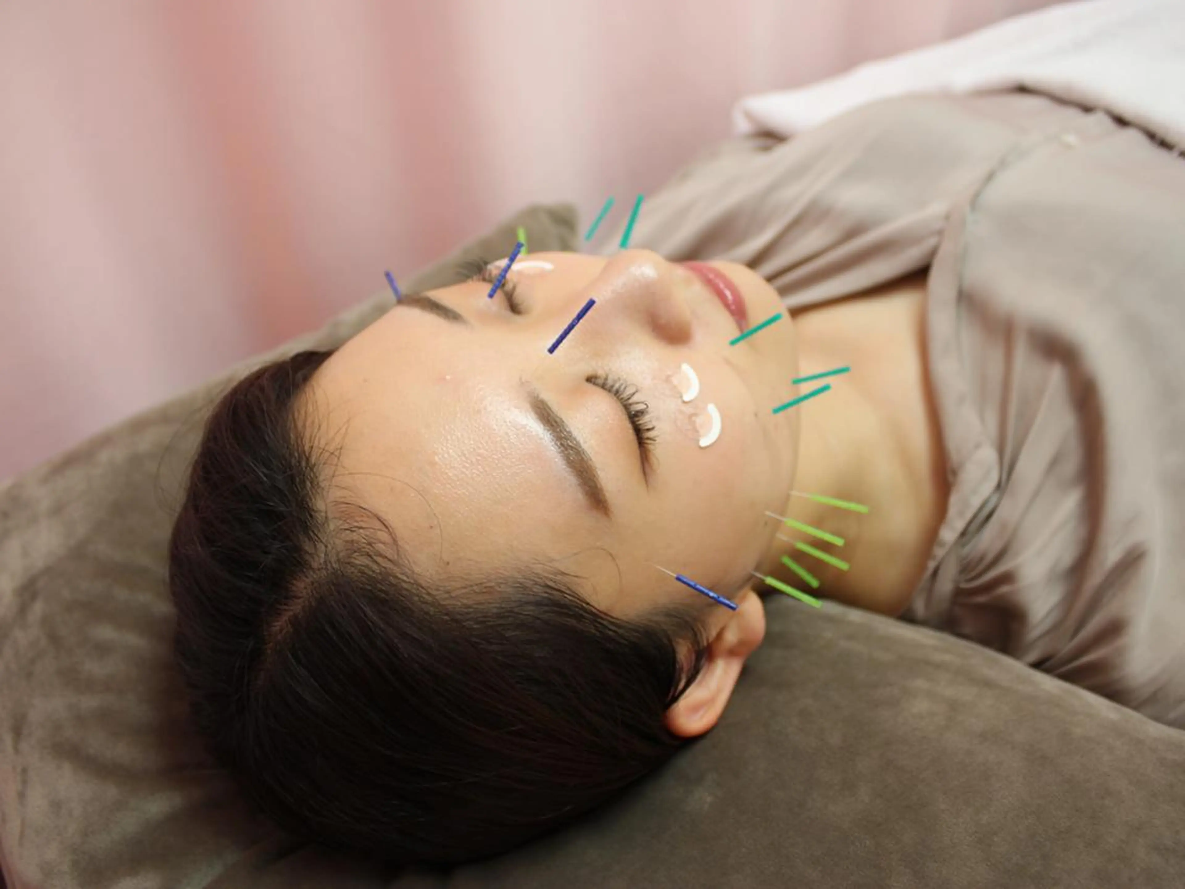 エステ 同心整骨院 美容鍼・整体・小顔のエステ・リラクイメージ