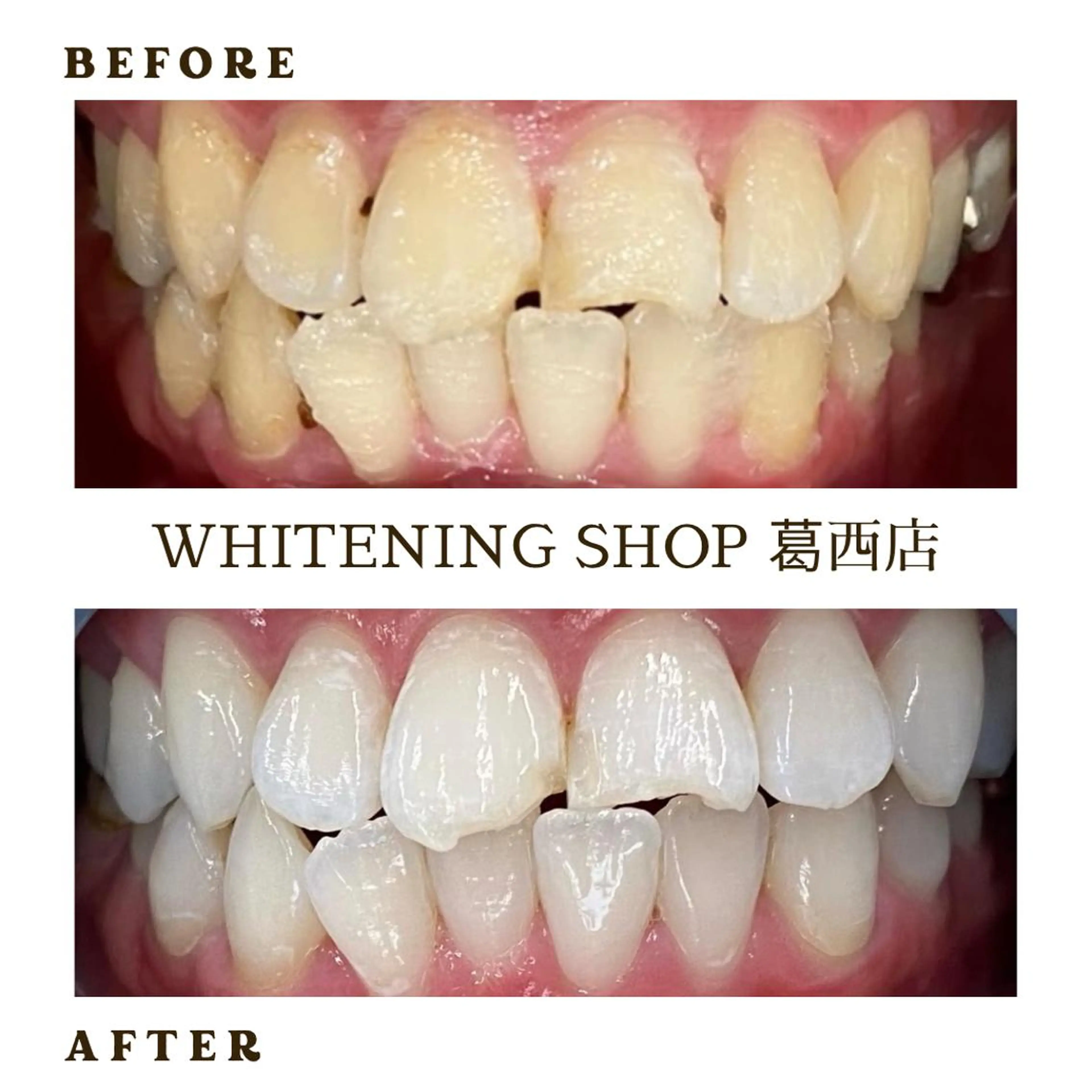 メンズ その他 ホワイトニング ショップ葛西店のその他イメージ