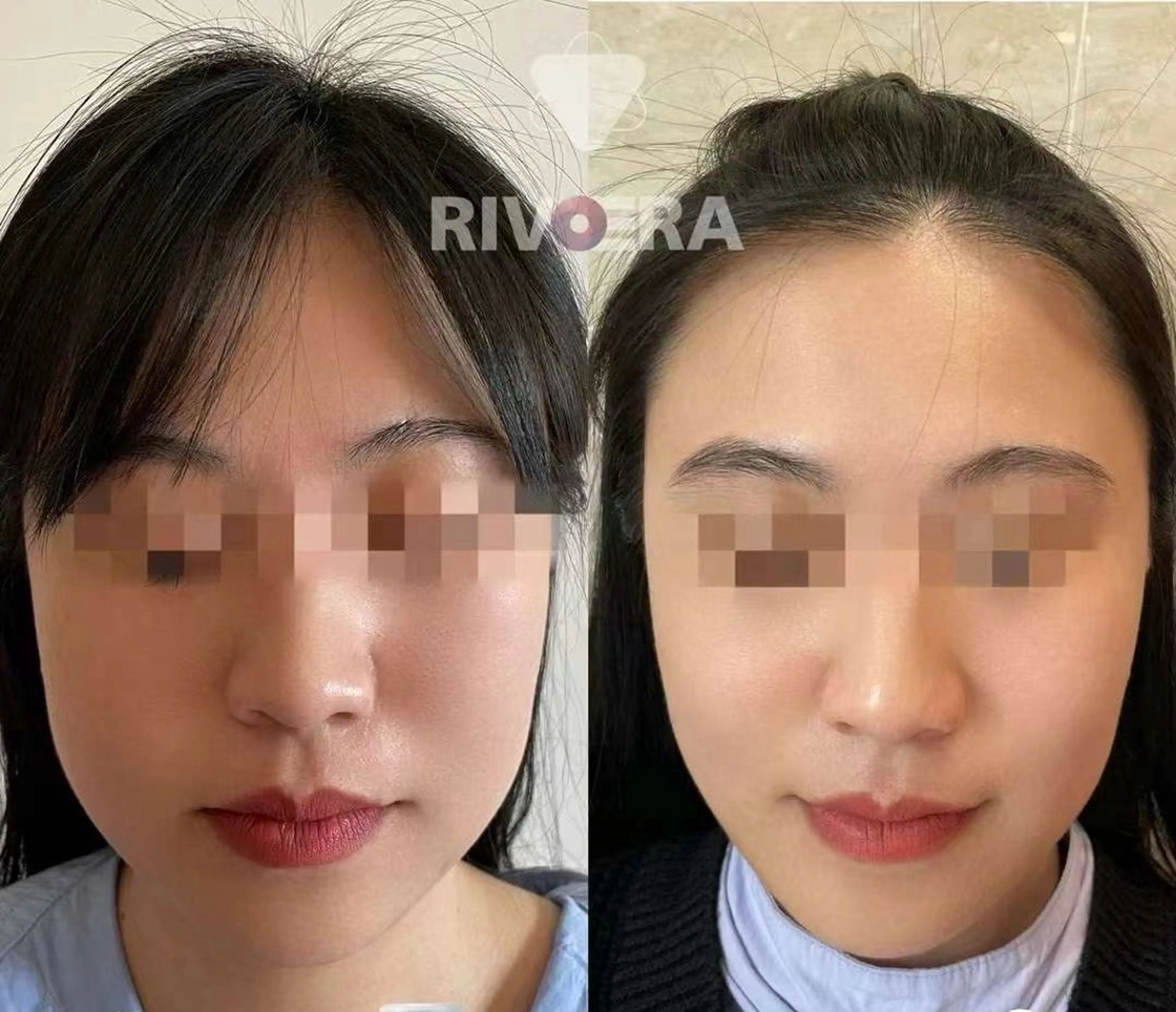 マツエク・マツパ エステ aliaハイフ&水光ジェットサロン所属・aliaハーブ水光店 エステティシャン募集のエステ・リラクイメージ