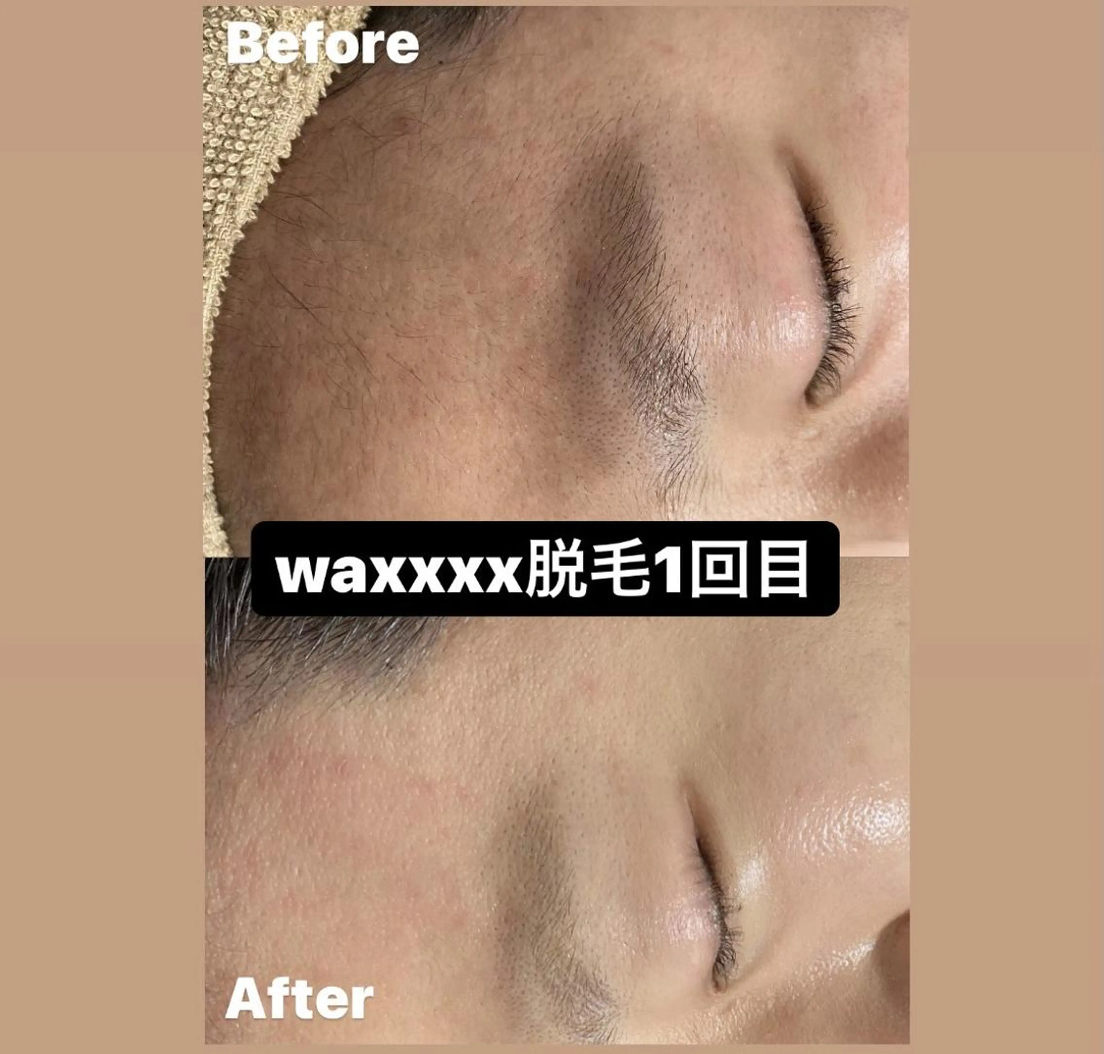 脱毛 Epina 千葉店 【エピナ】のエステ・リラクイメージ