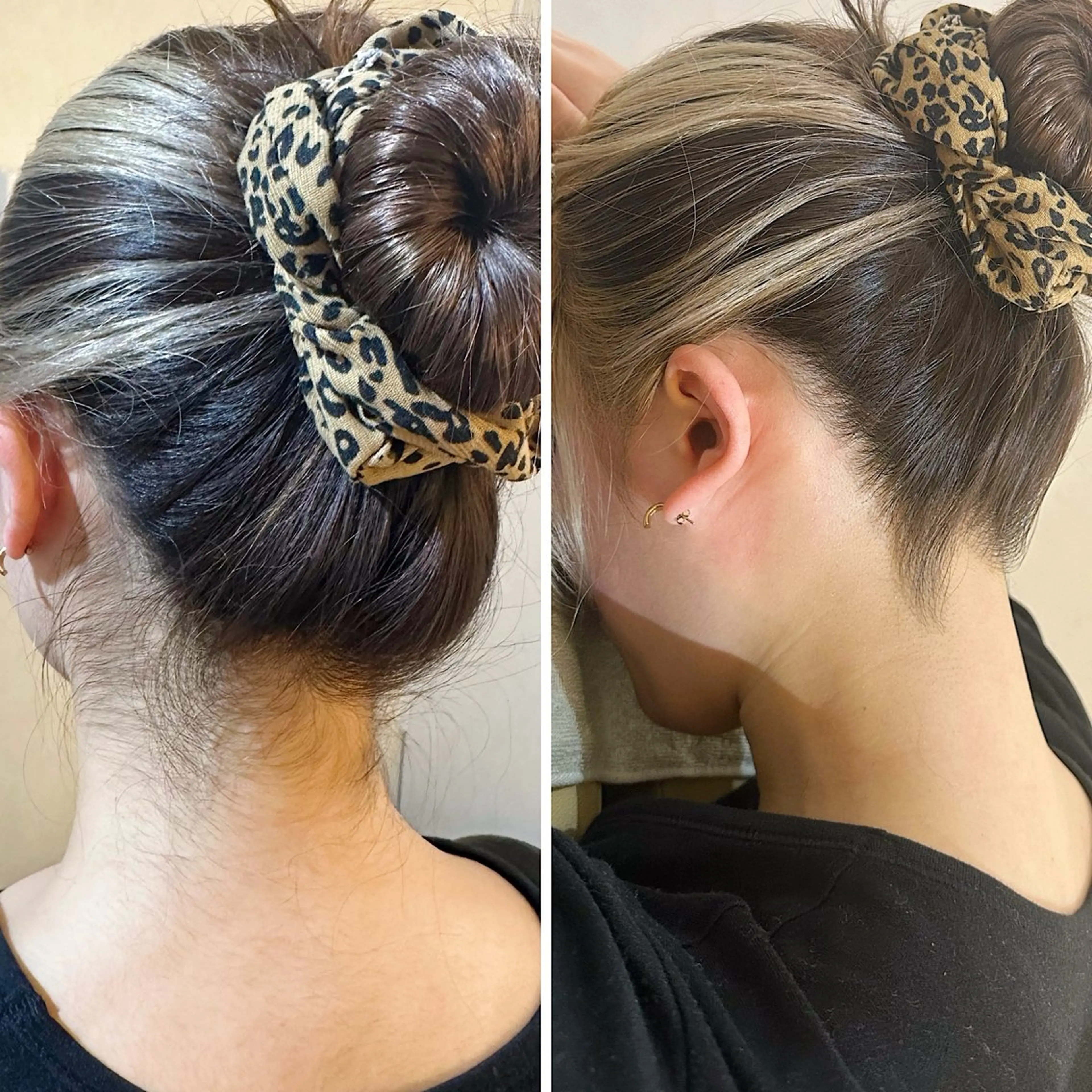 脱毛 うなじ脱毛/美肌脱毛 LABELのエステ・リラクイメージ