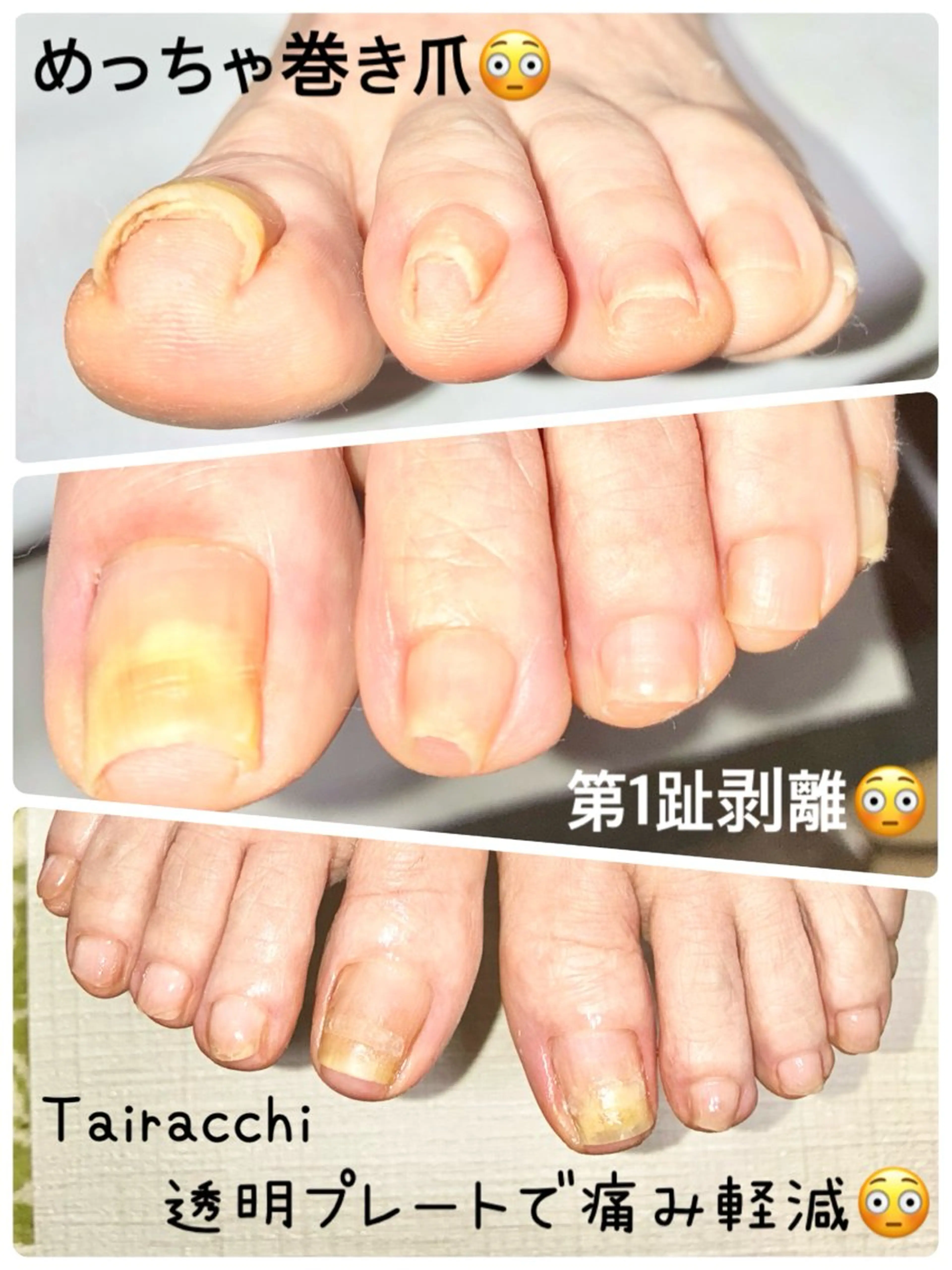 ネイル フットネイル Tairacchi ﾀｲﾗｯﾁのエステ・リラクイメージ