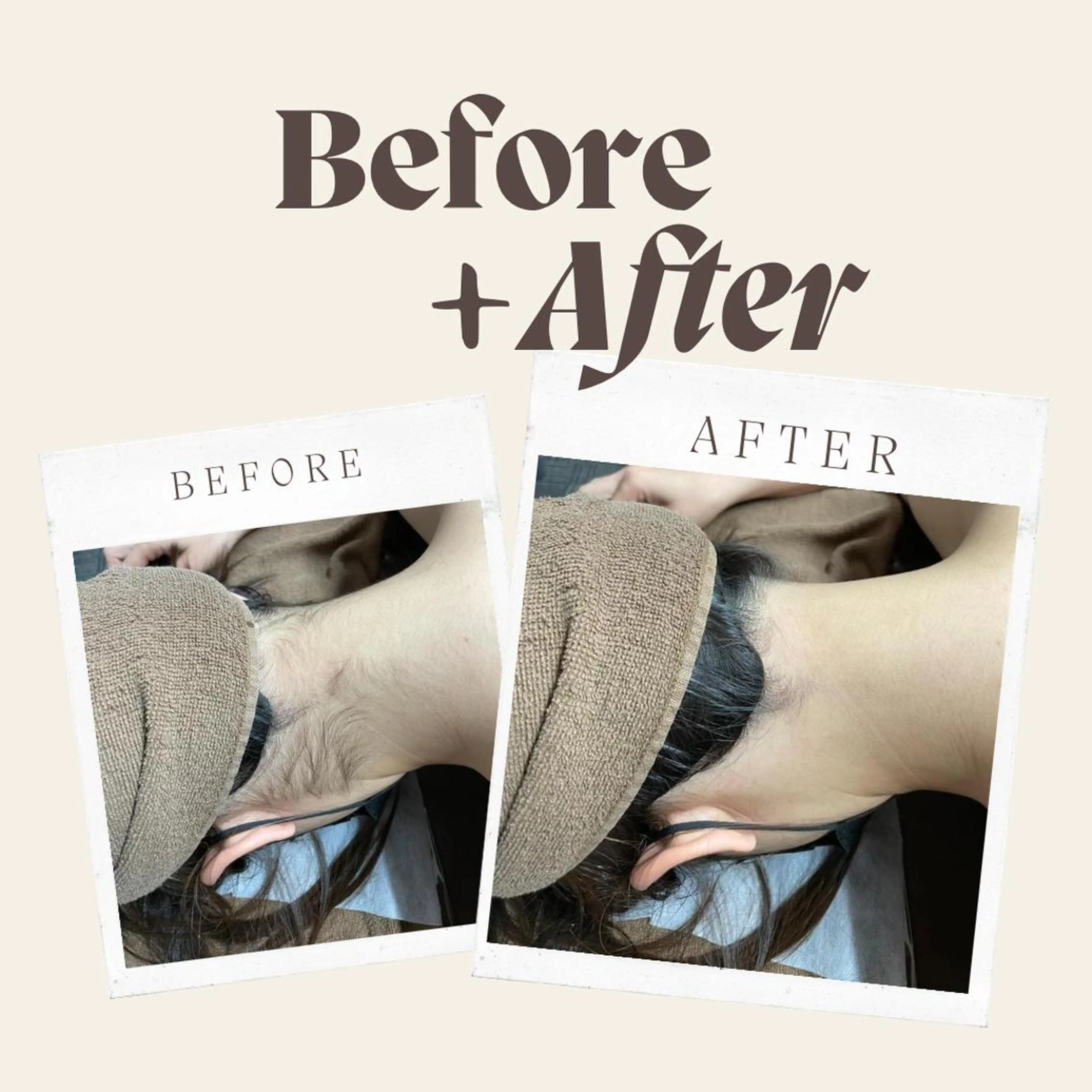 RinRin 甲府店のエステ・リラクイメージ