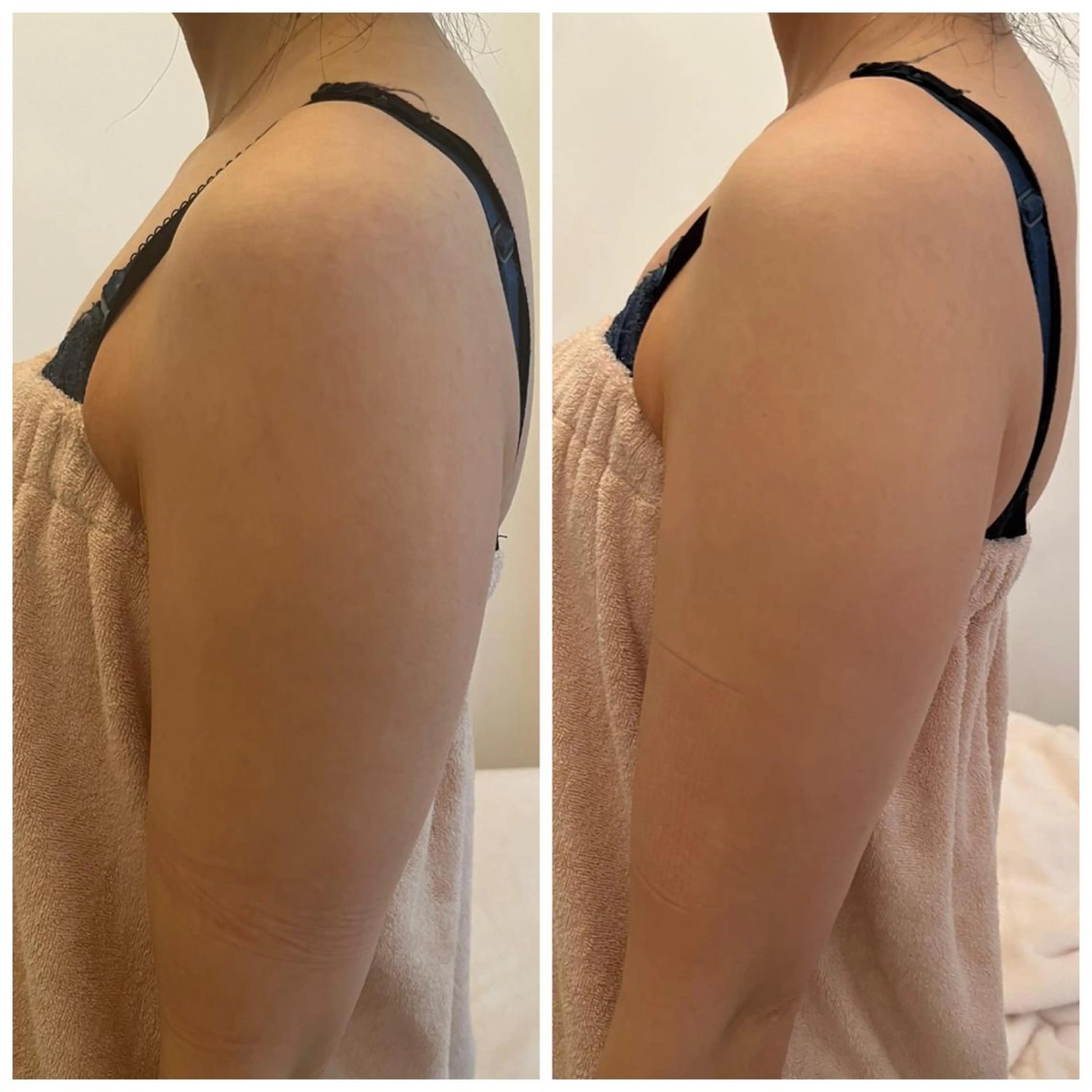 秒速小顔 新宿店 さきのエステ・リラクイメージ