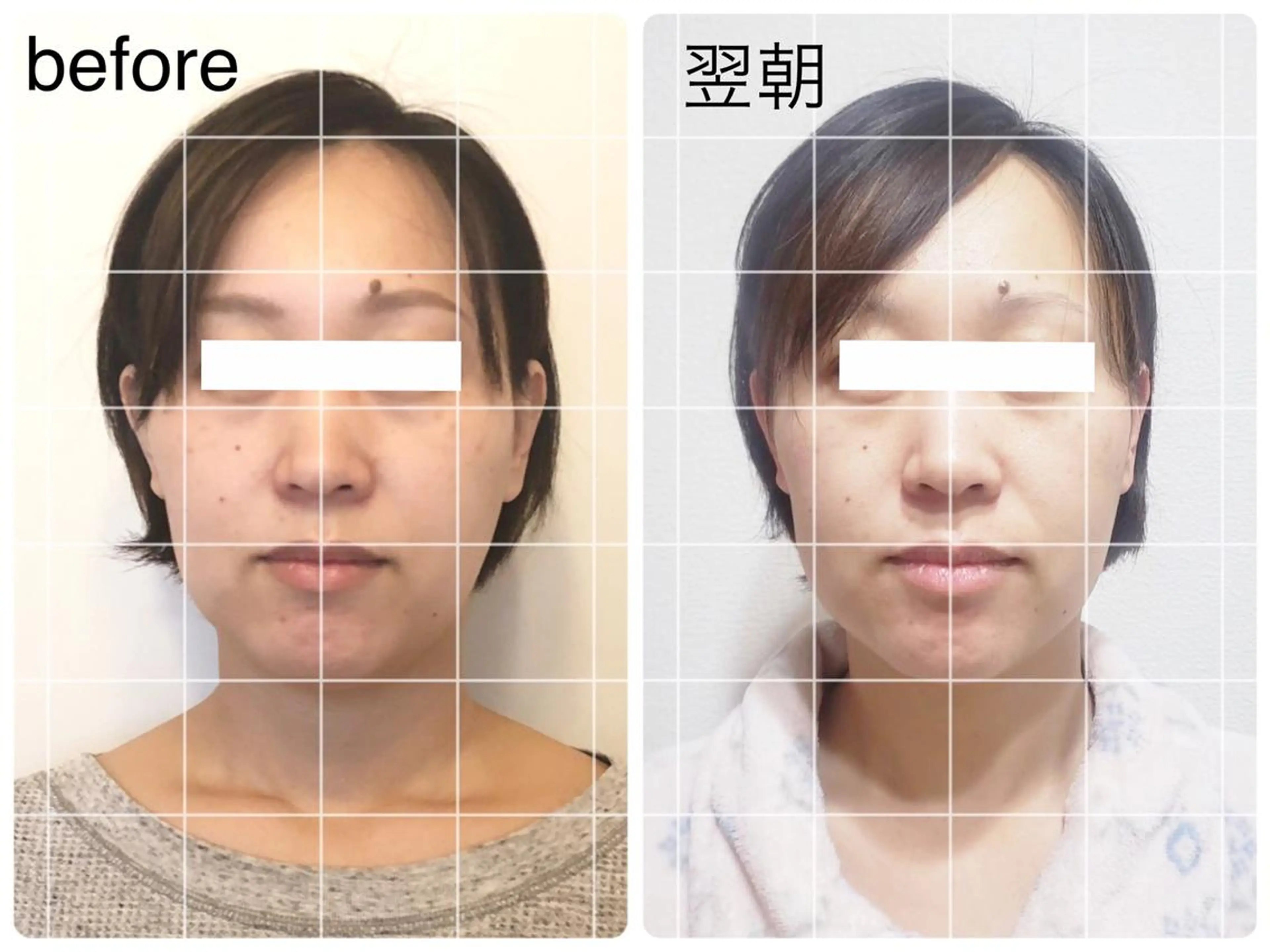 エステ リラク 小顔矯正ドライヘッド Arincoのエステ・リラクイメージ