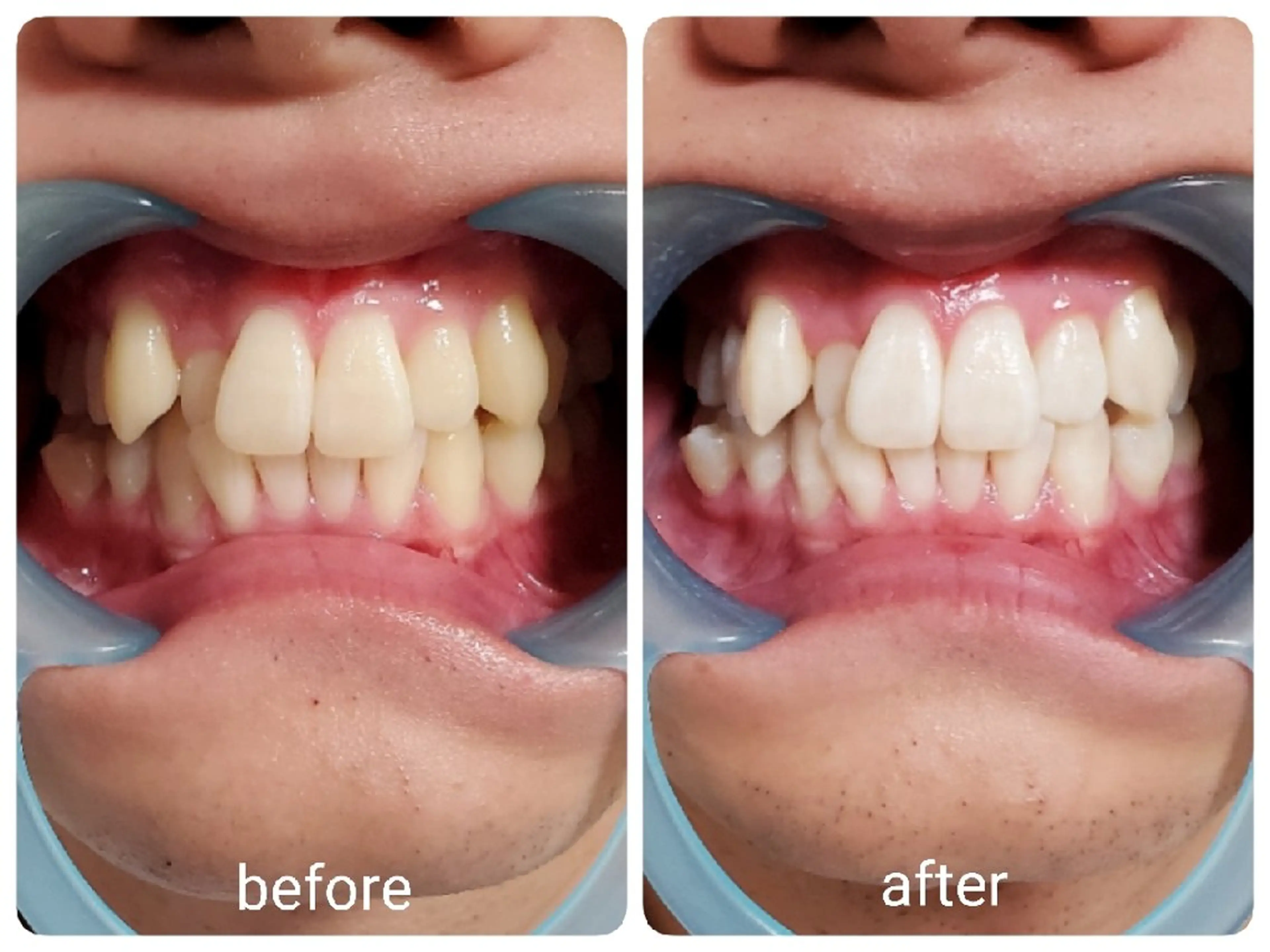 mindplus(マインドプラス)所属・mind plus 【小顔　痩身　脱毛】のエステ・リラクイメージ