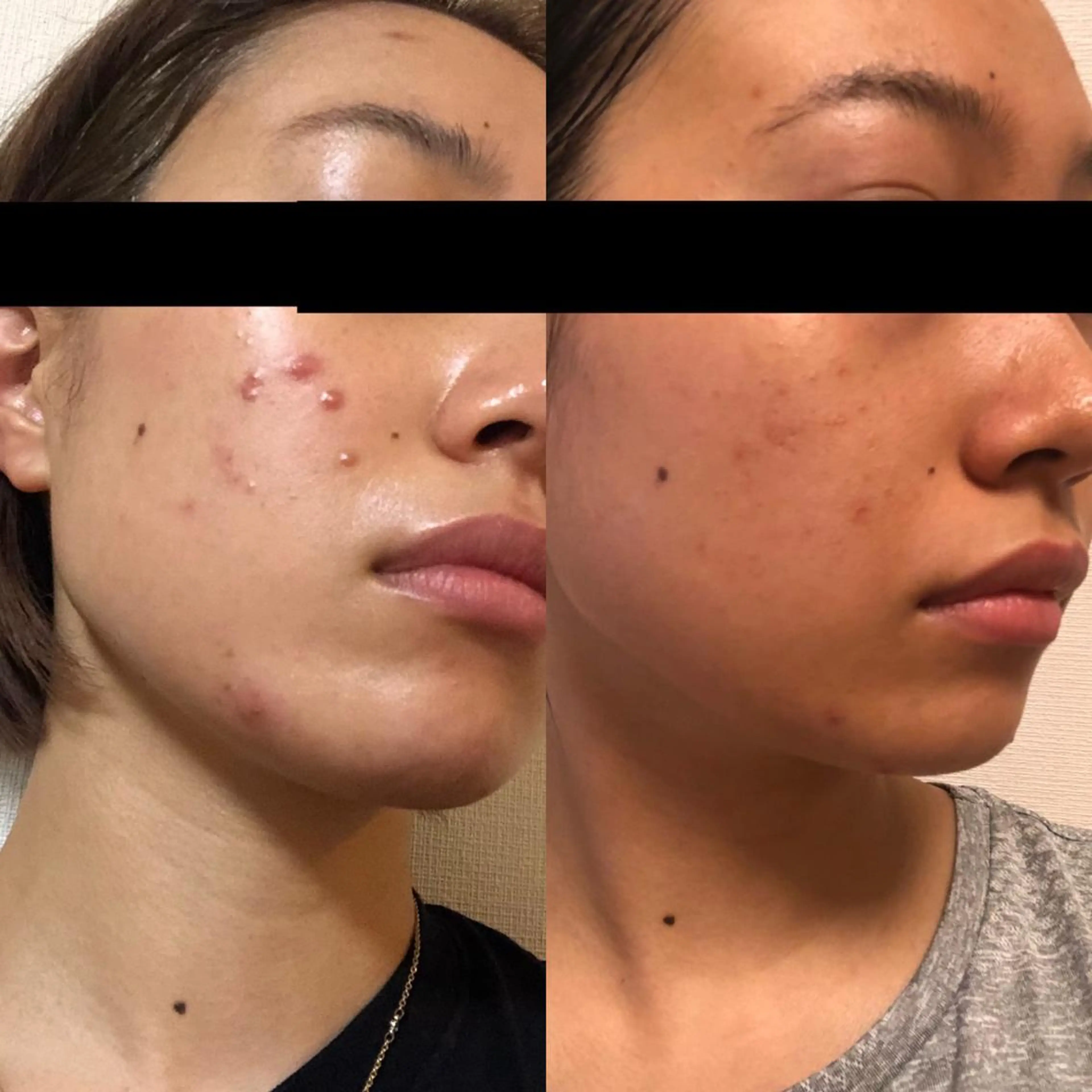 朝重い人専用 肩甲骨調整のエステ・リラクイメージ