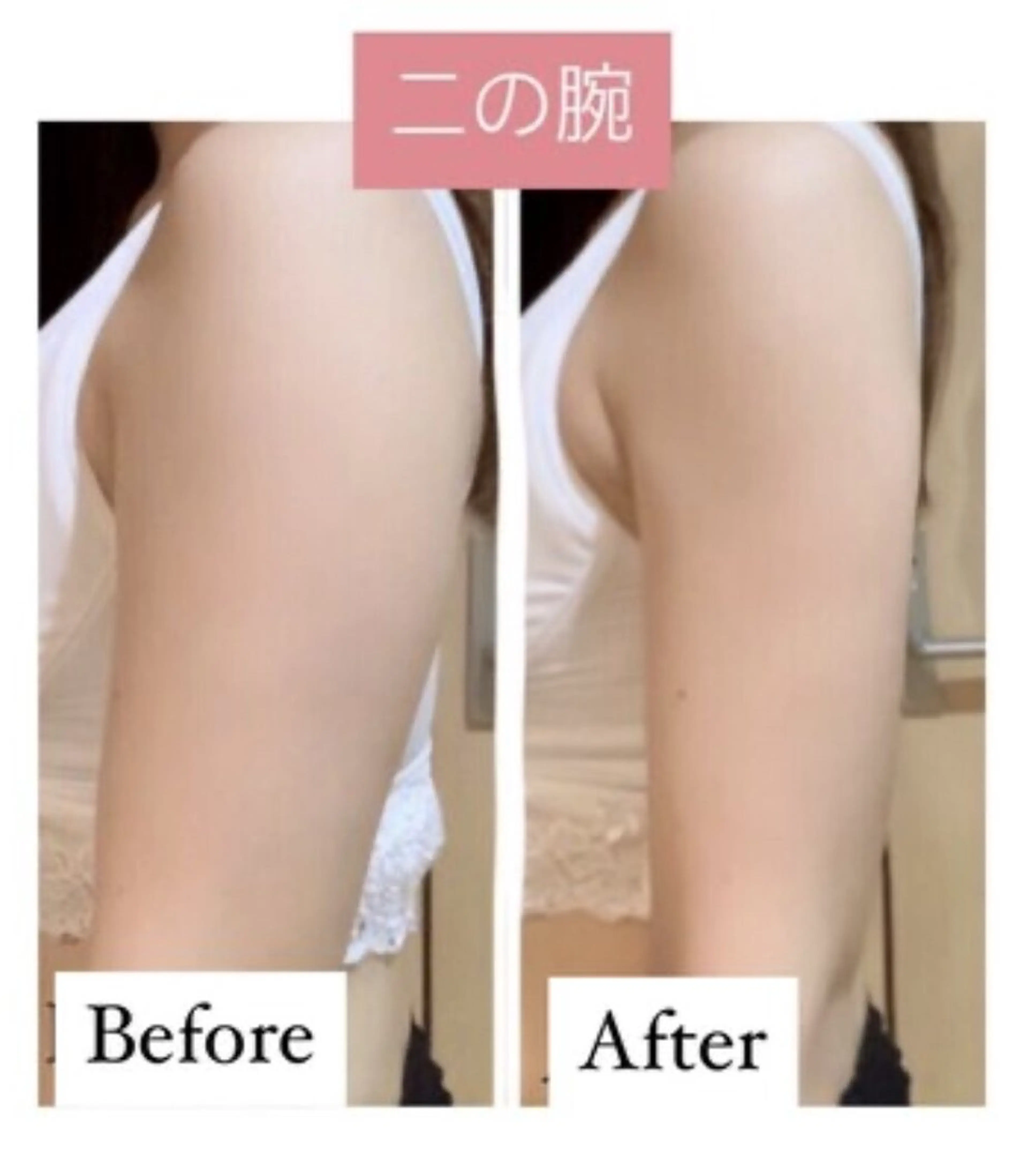 その他 秒速小顔 岩邊のその他イメージ