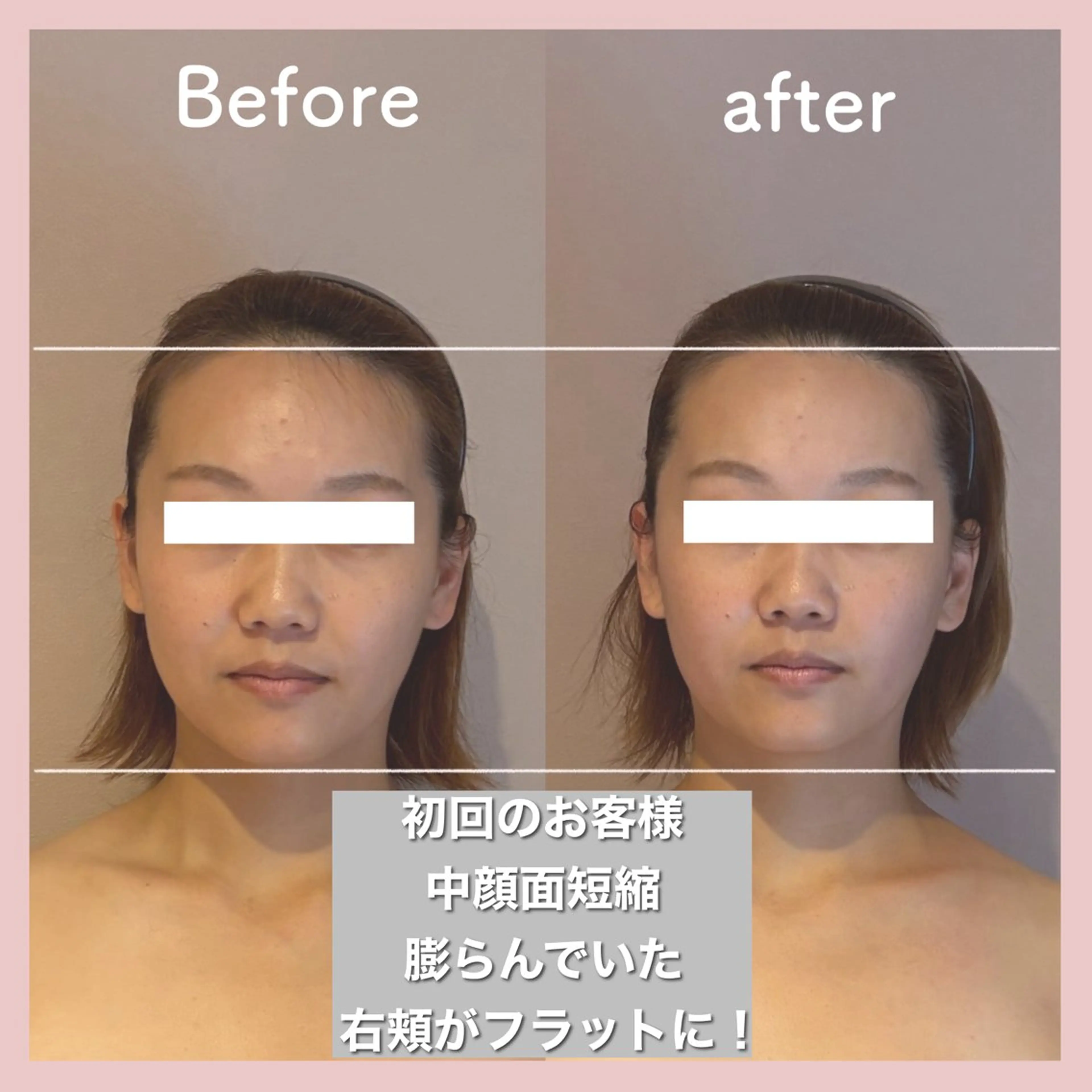 小顔矯正専門店Gémiey所属・越谷駅徒歩３分 小顔専門Gemieyのエステ・リラクイメージ