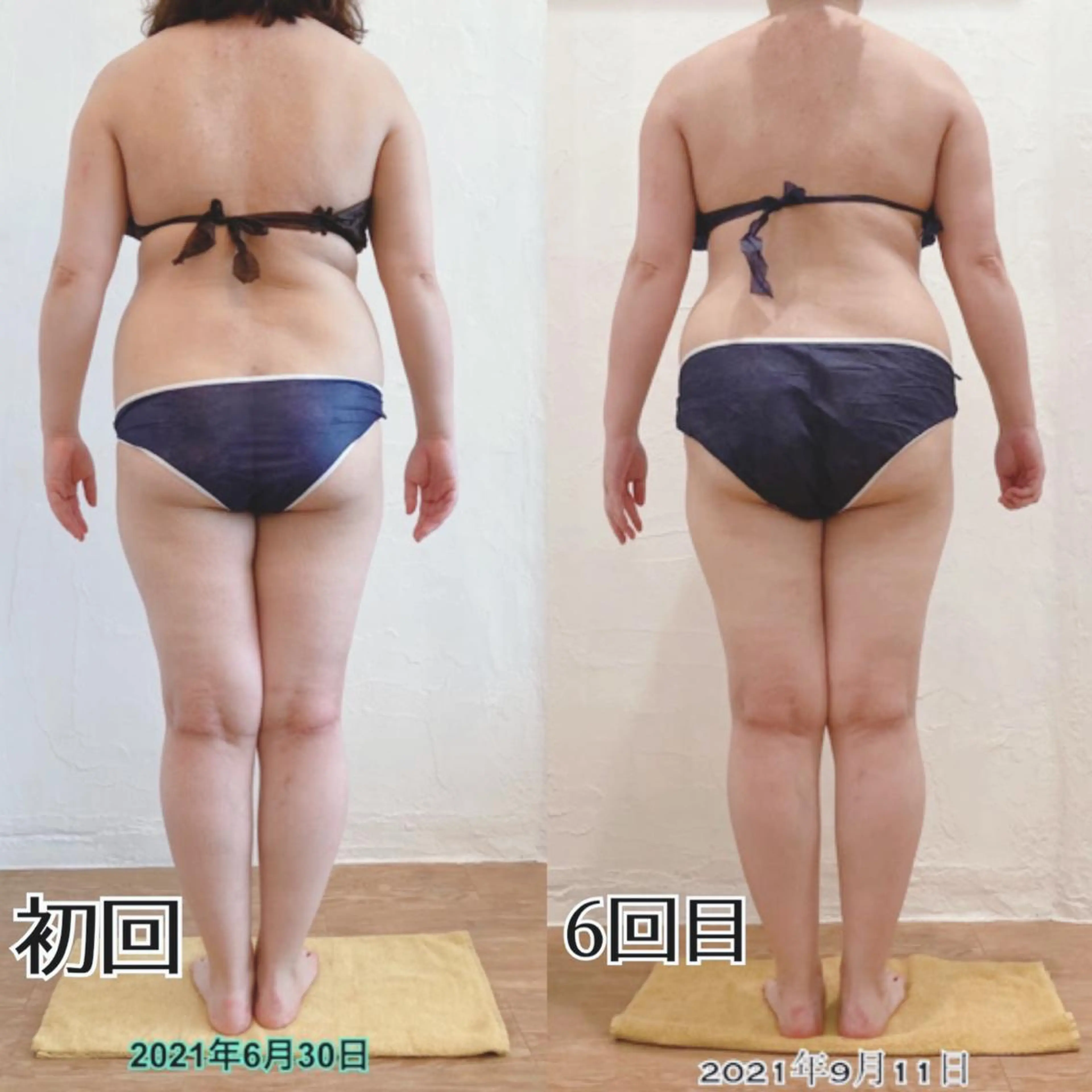 エステ リラク むくみ専門痩身 マクイエステティックのエステ・リラクイメージ