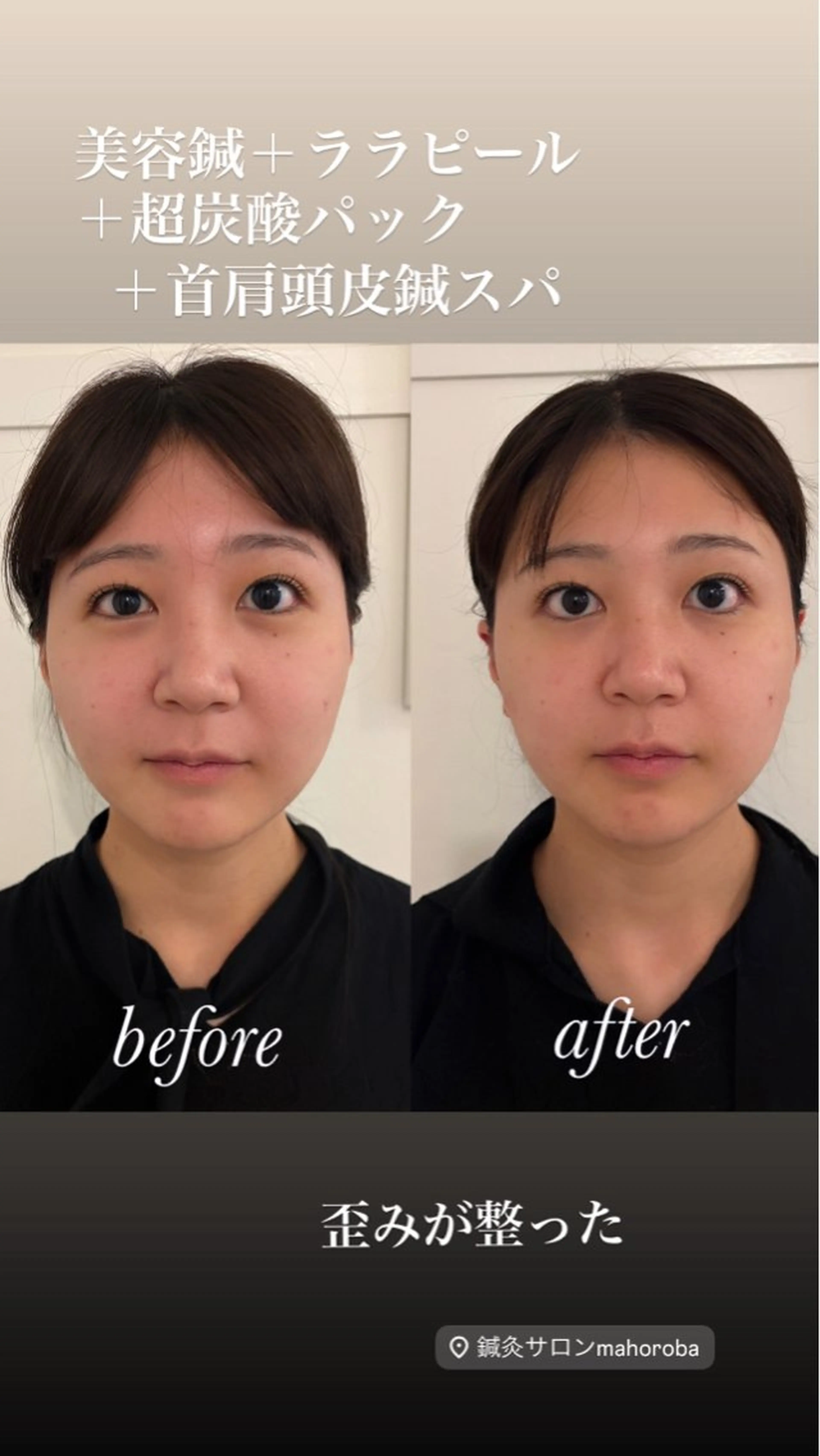 エステ リラク 美容鍼灸サロン mahoroba院長のエステ・リラクイメージ