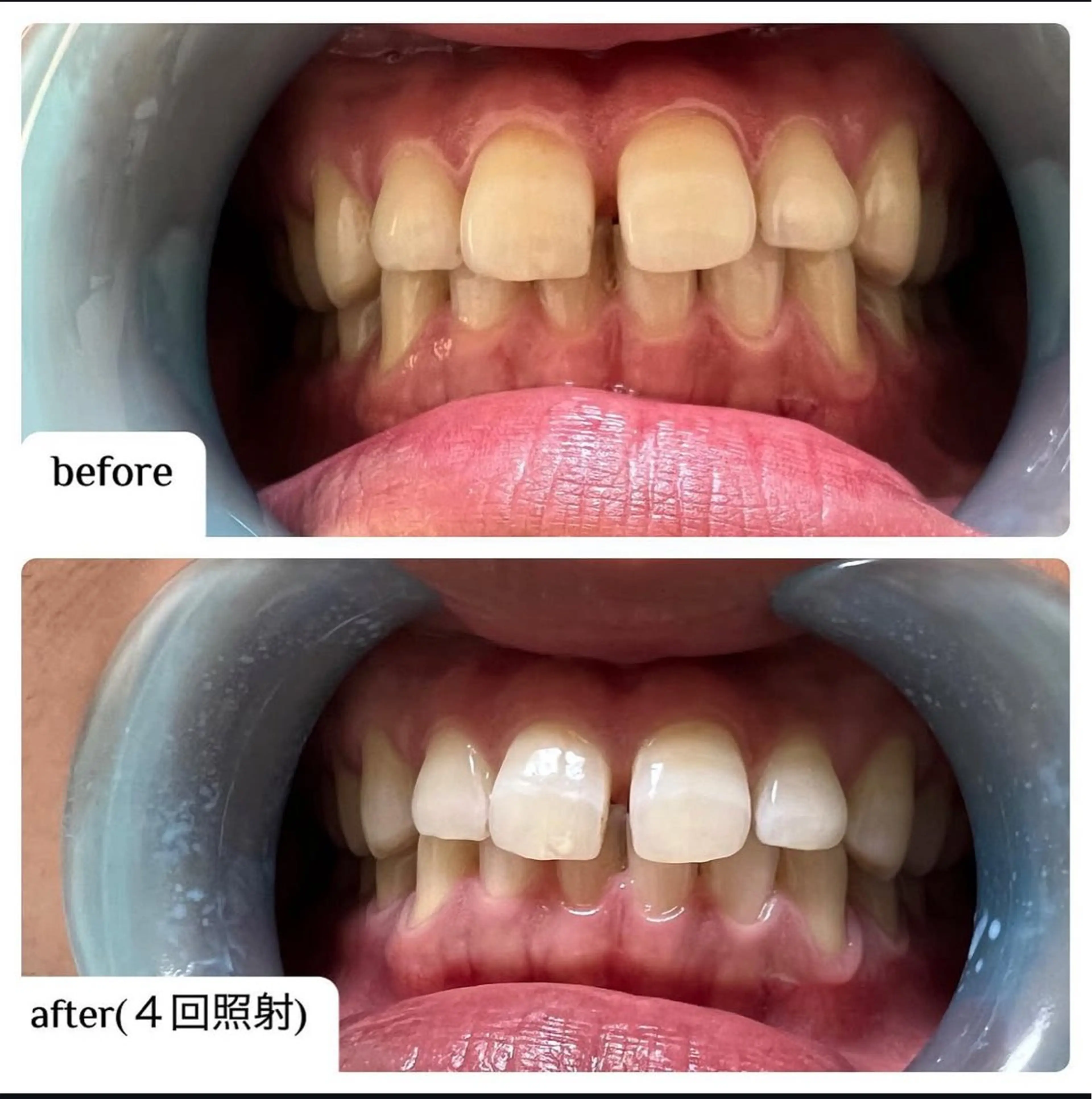 メンズ ☀️Akala☀️ メンズ脱毛のエステ・リラクイメージ