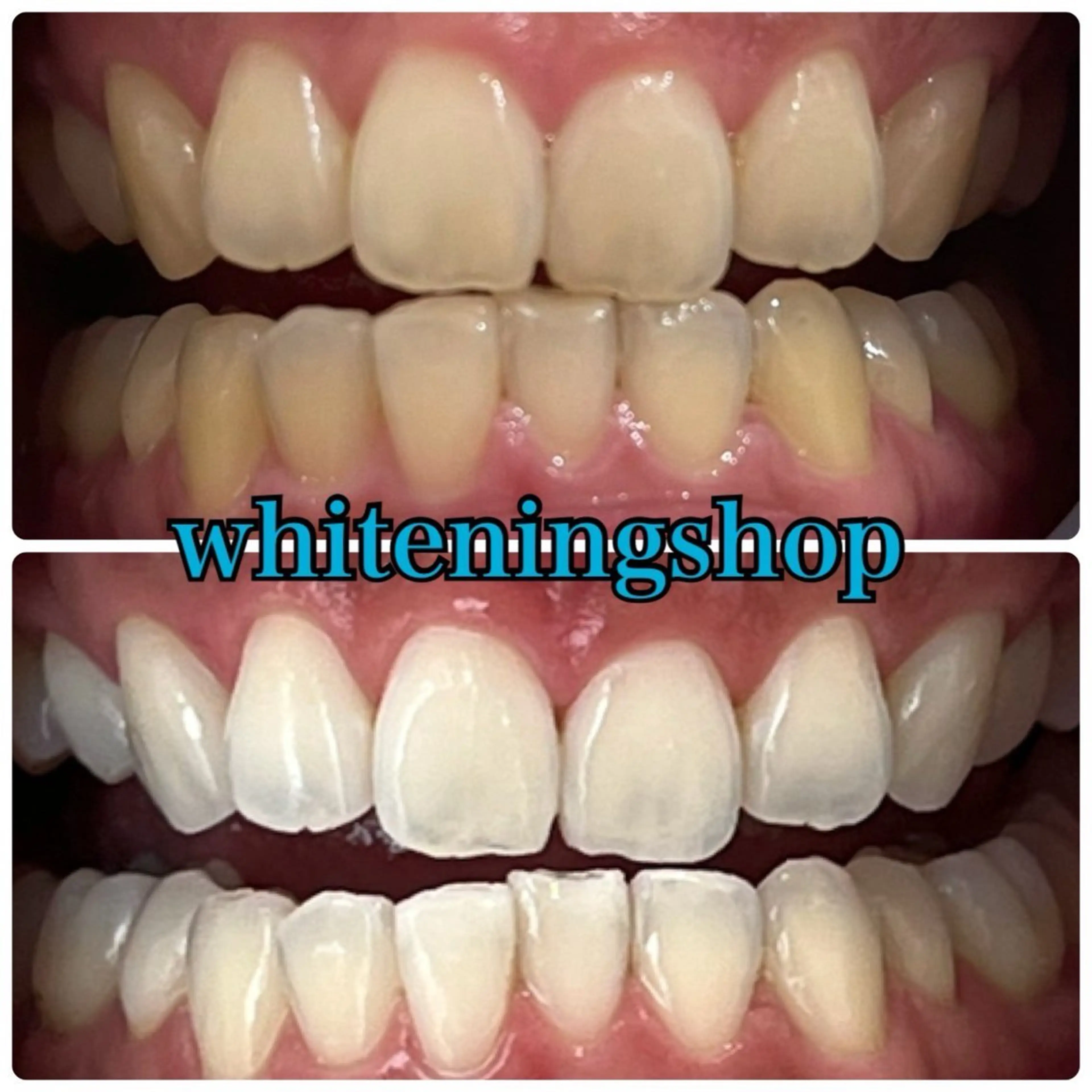 メンズ エステ リラク ホワイトニング ショップ川越店のエステ・リラクイメージ