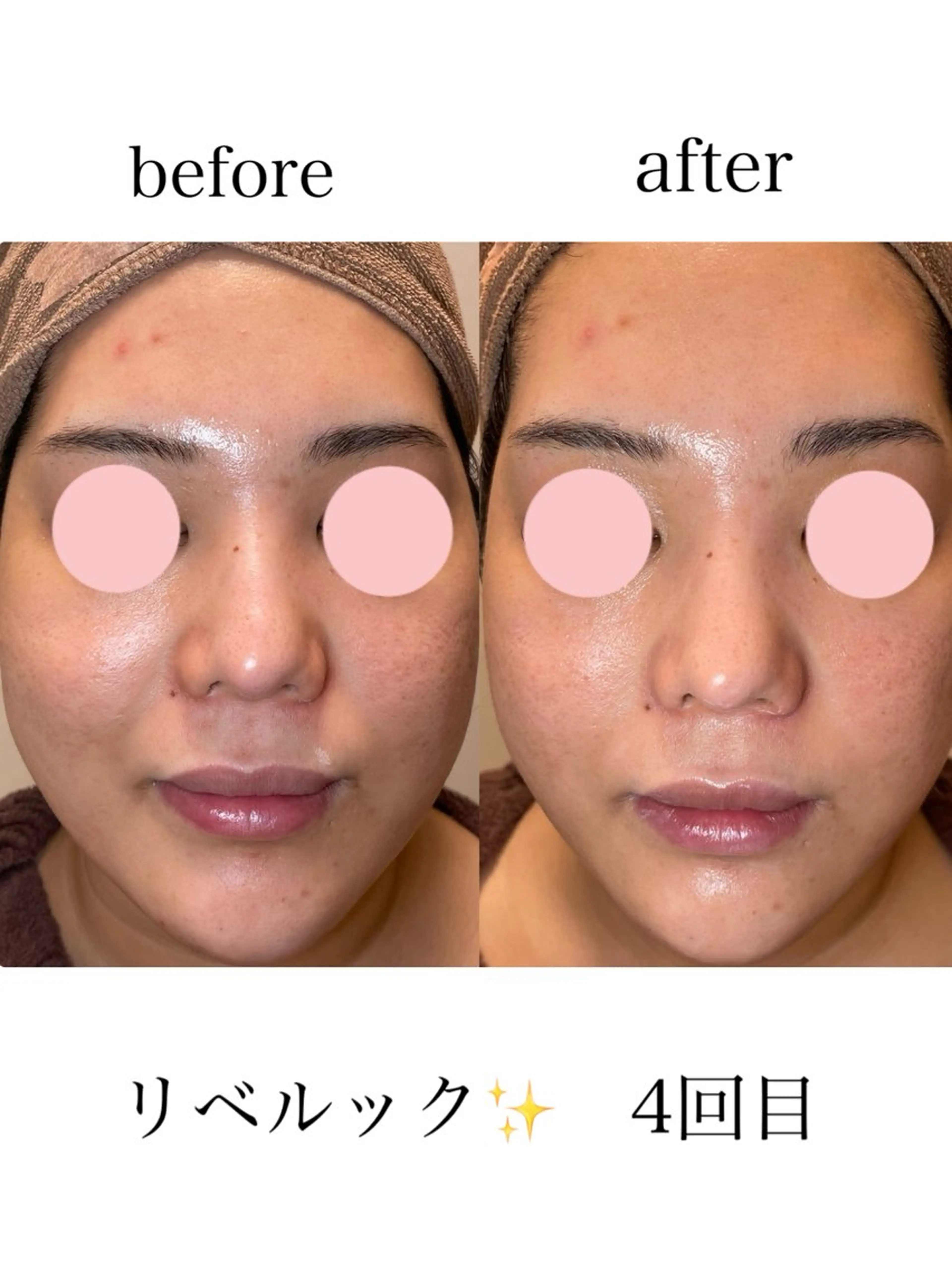 エステ コンセプトサロン友 かすみのエステ・リラクイメージ