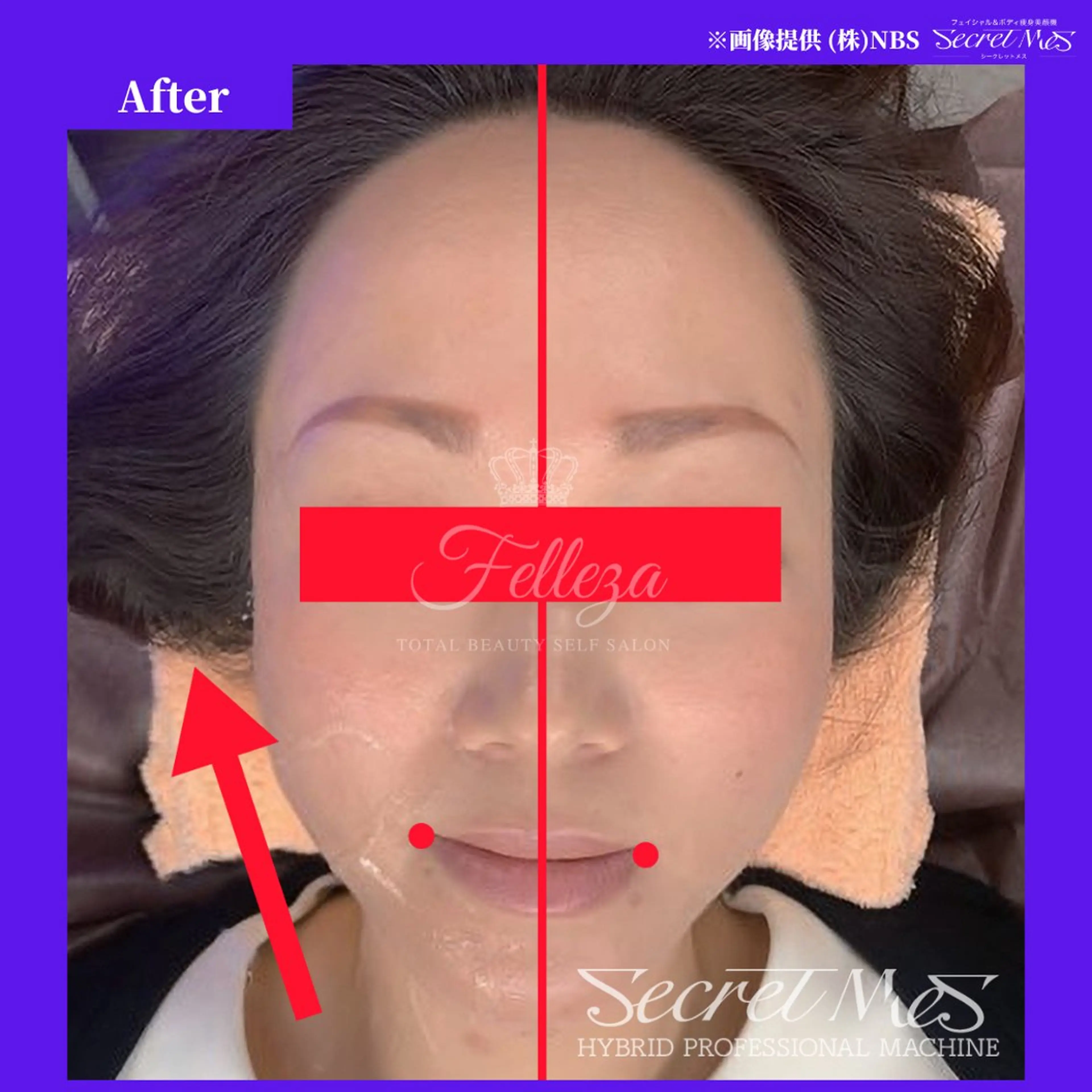 メンズ 有人型セルフサロン 脱毛／痩身／美顔のエステ・リラクイメージ