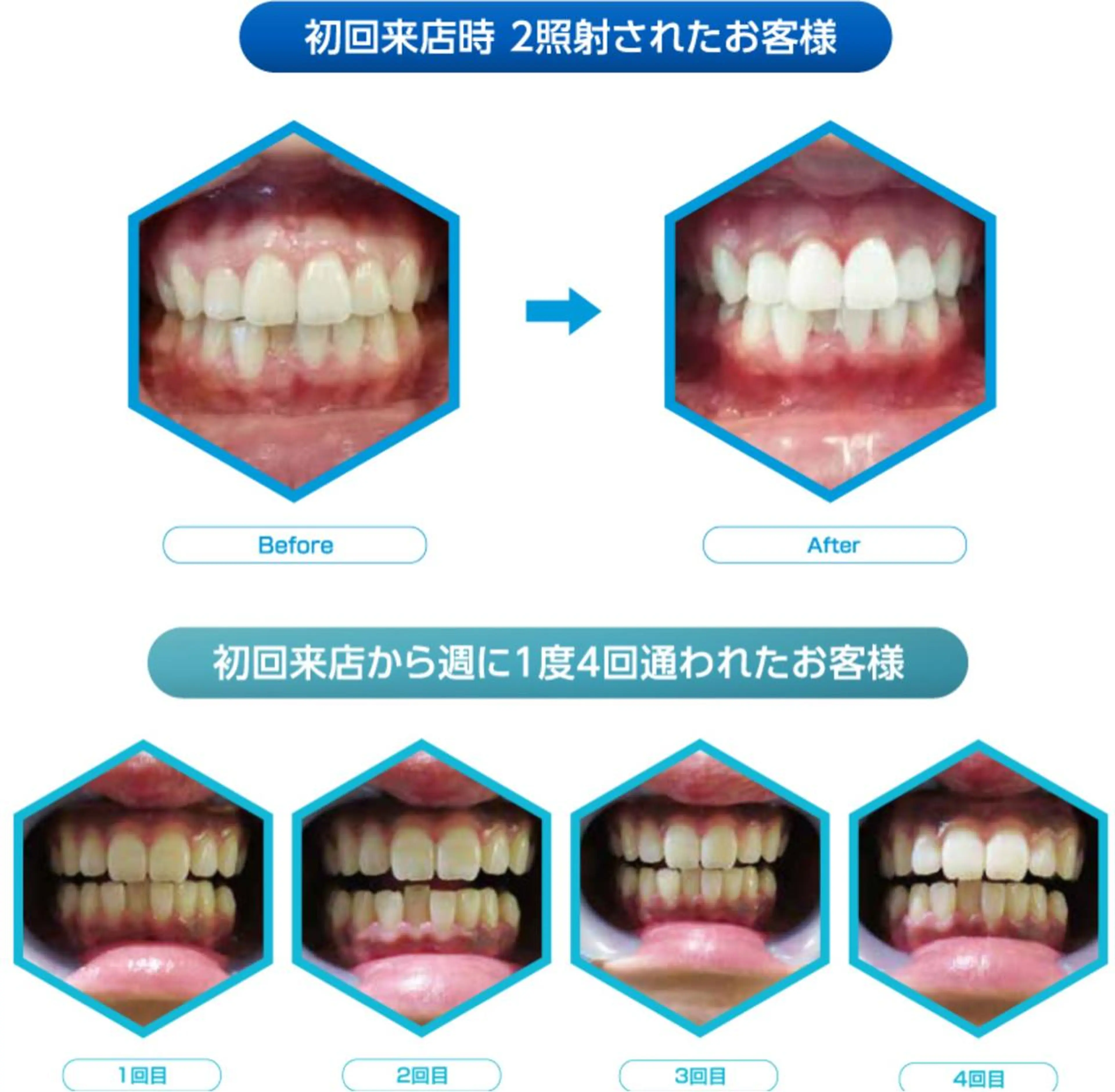 Venus Beauty銀座のマツエク・マツパデザイン