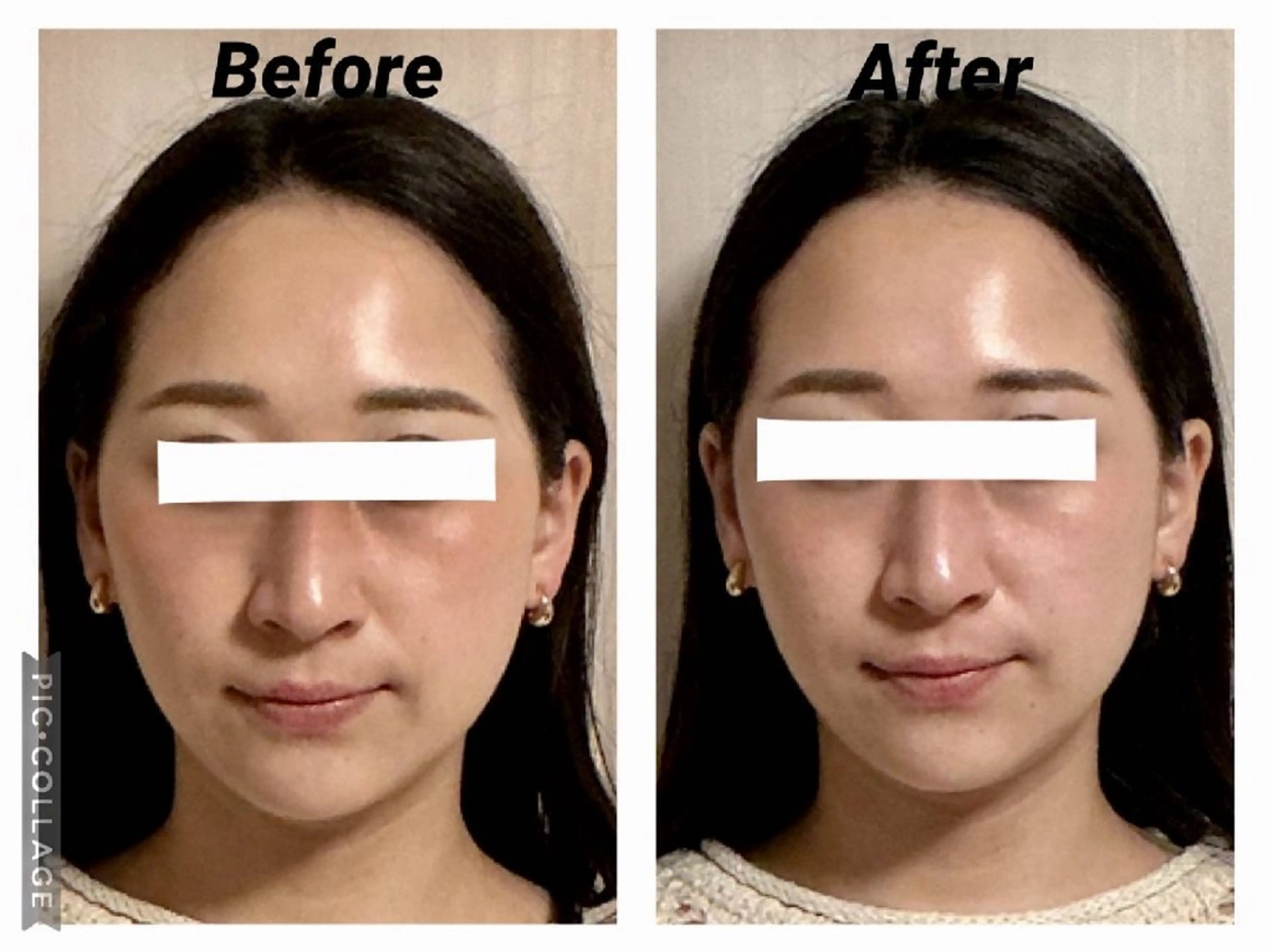 エステ リラク 小顔矯正Sho  FaceDesignのエステ・リラクイメージ