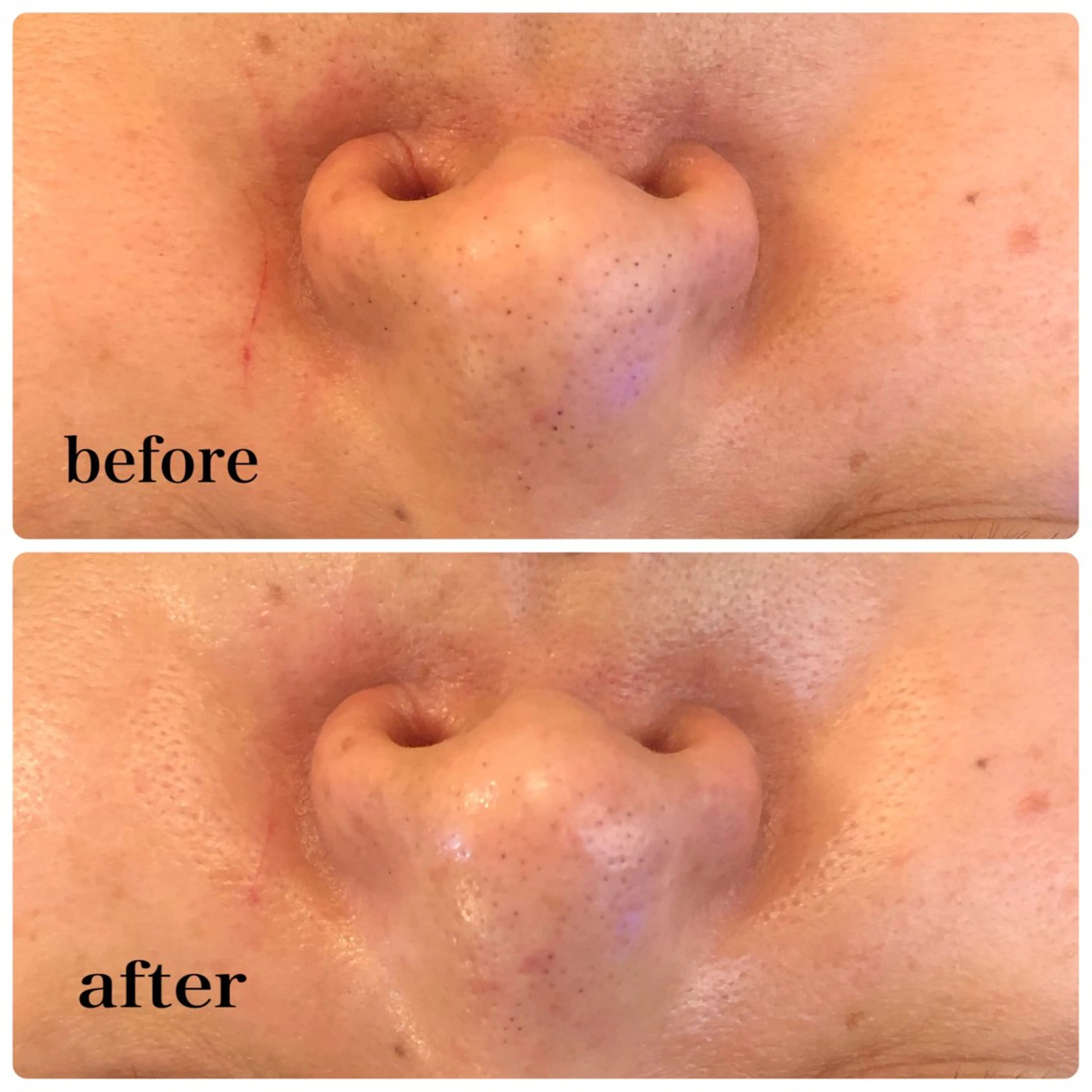 毛穴のお悩み・シミ 松本瞳のエステ・リラクイメージ