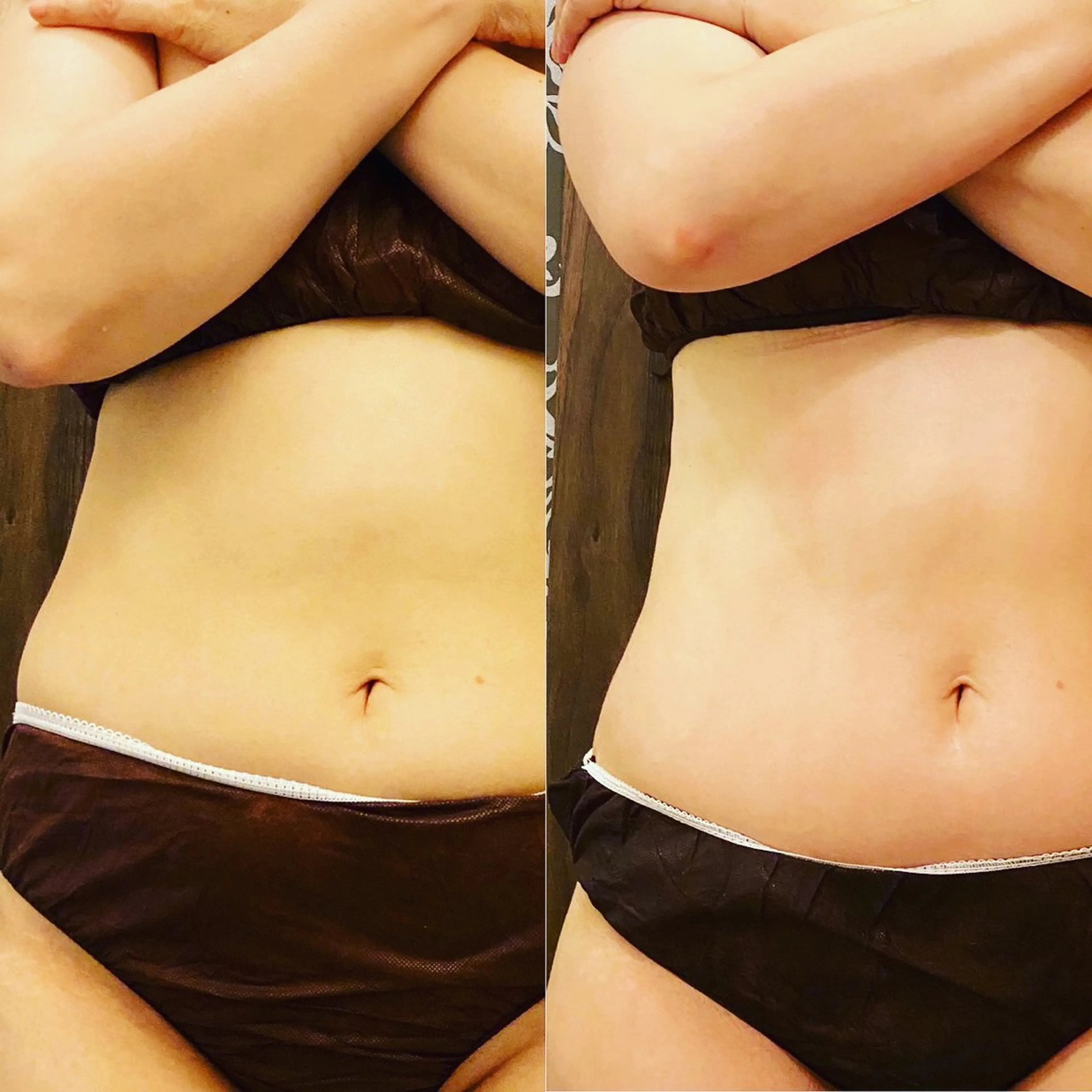 エステ トータルビューティー マウロアのエステ・リラクイメージ