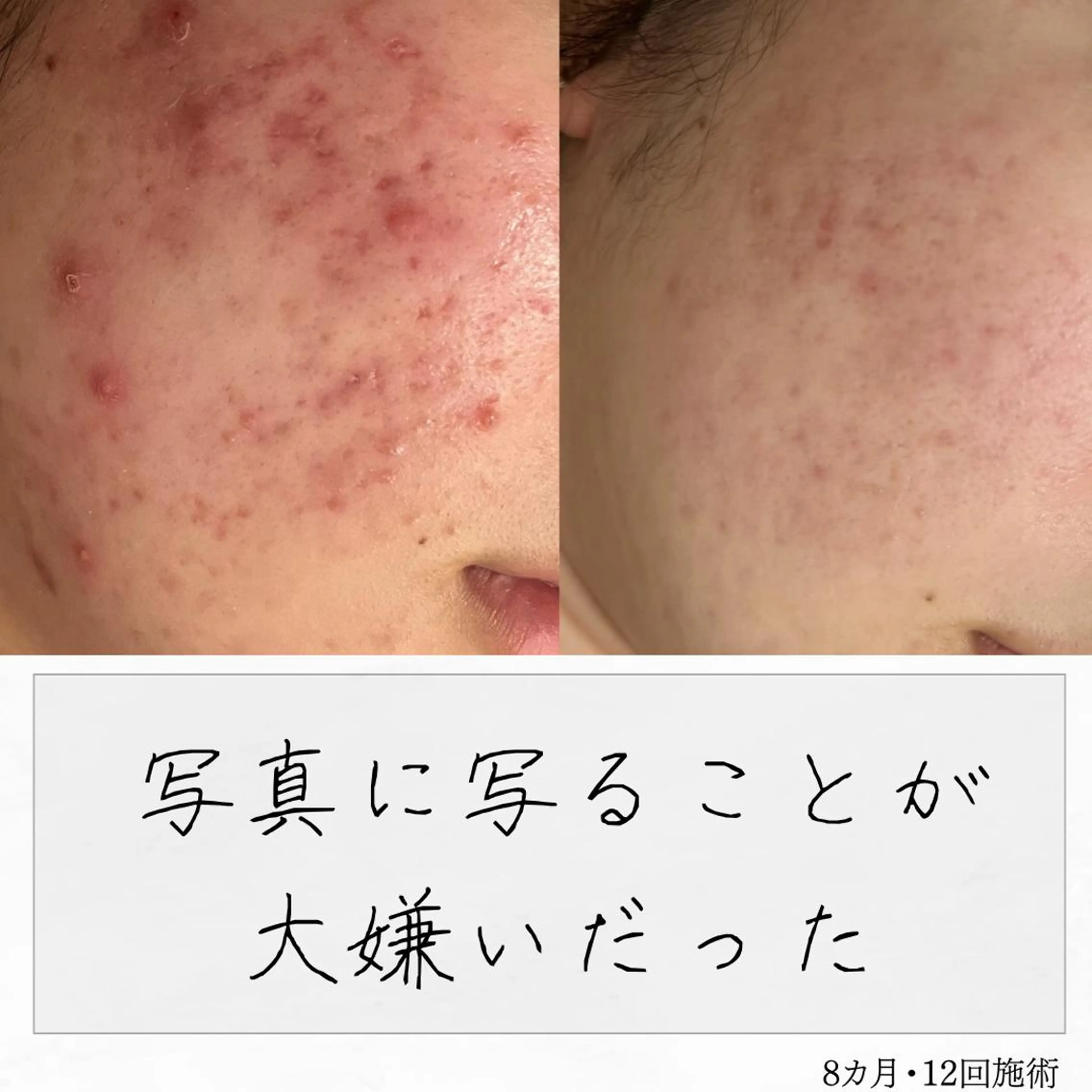 ニキビ経験者が施術 する専門サロン🌻のエステ・リラクイメージ