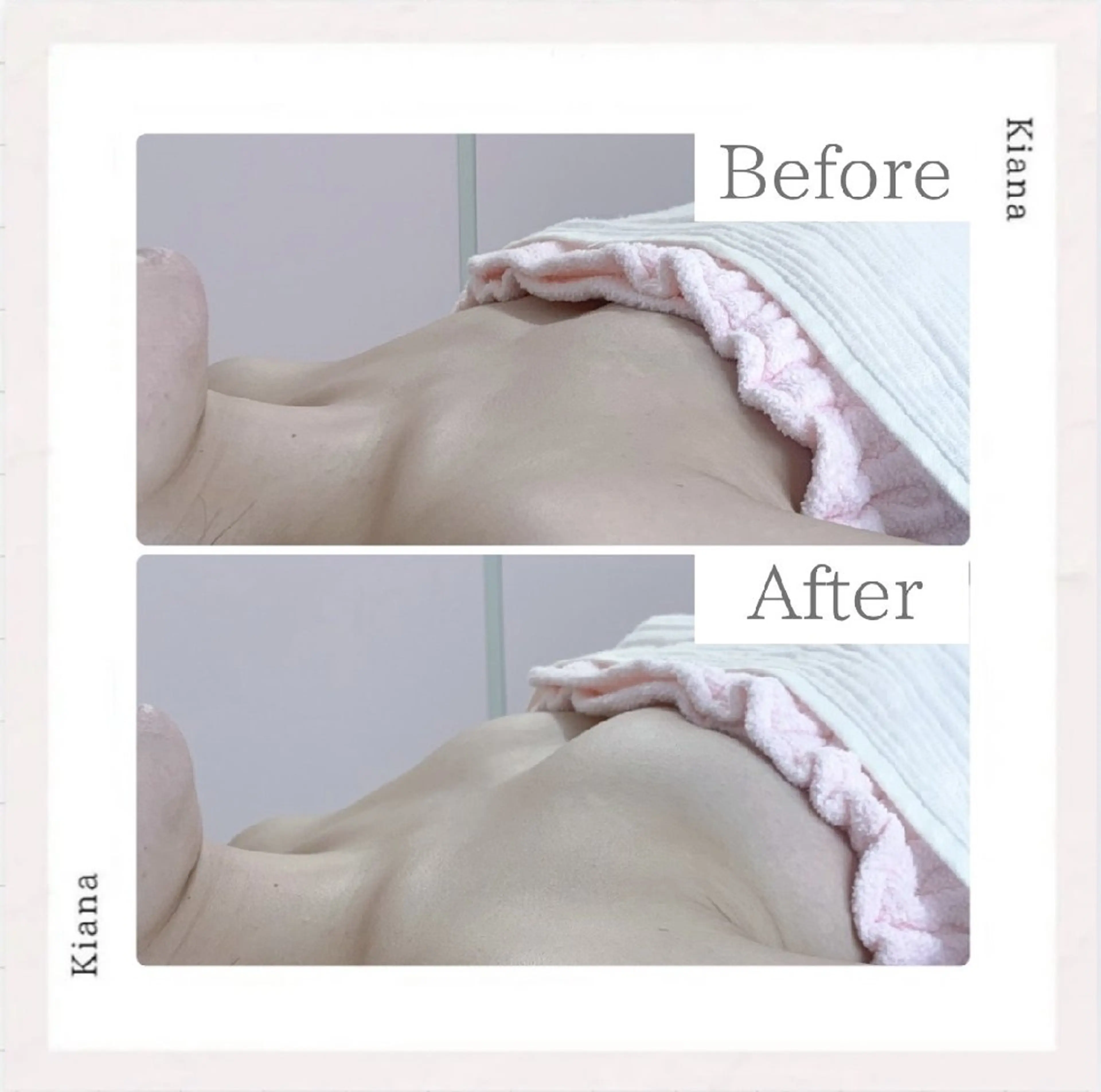 エステ リラク 【バスト専門店 】 Kiana のエステ・リラクイメージ