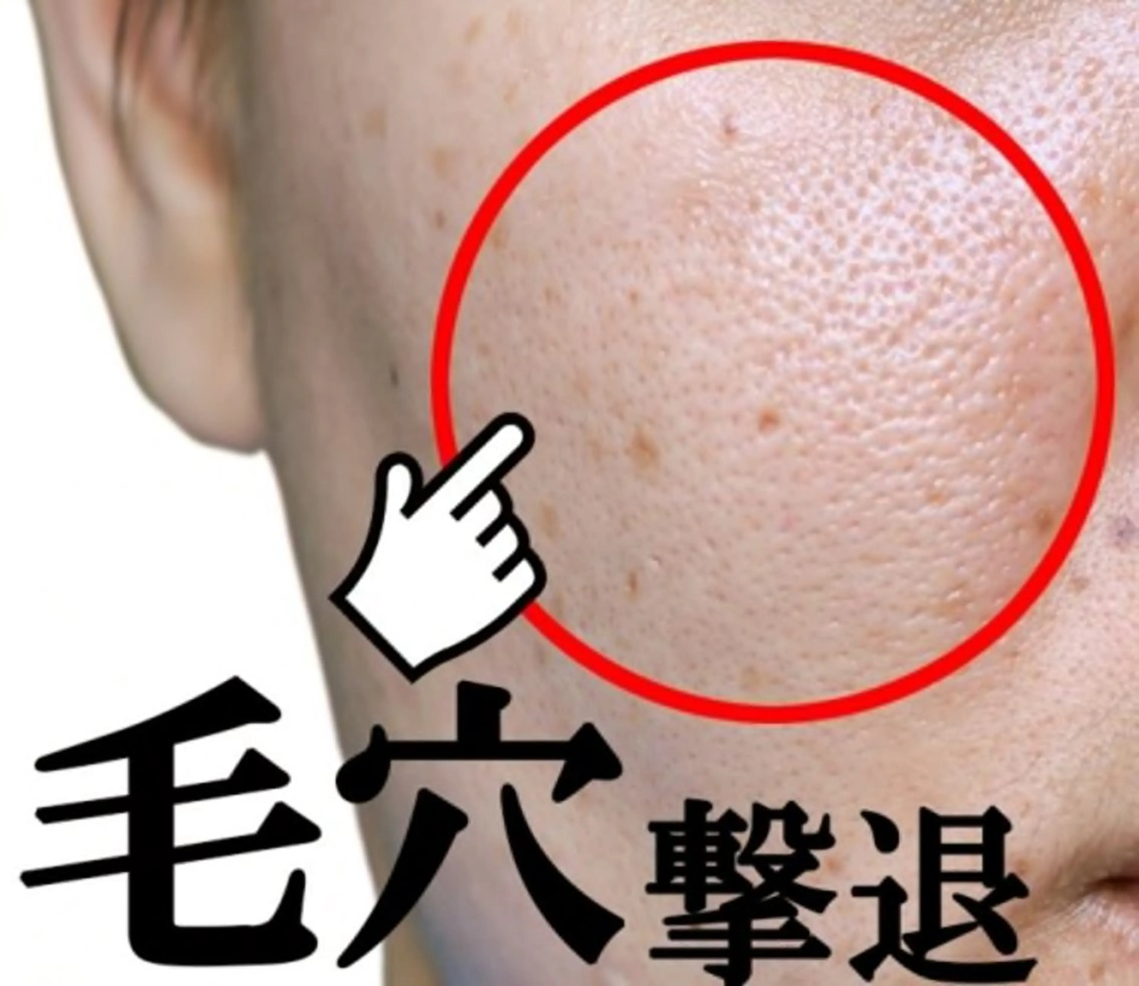 【お日にち限定】4月12日(日)時間:9:00​〜​15:00限定！小鼻の毛穴汚れ撃退！特別無料！の写真