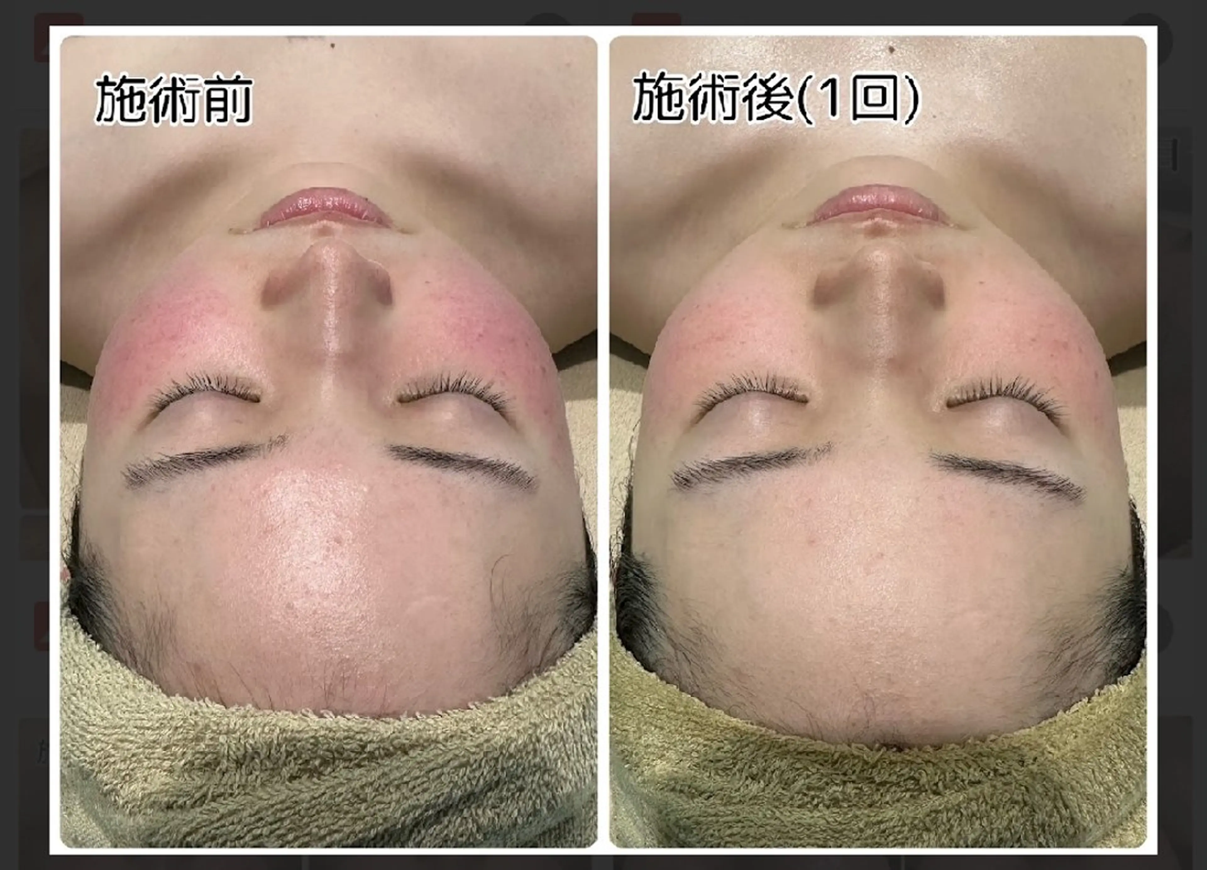 エステ LOUISE. ／脱毛のエステ・リラクイメージ