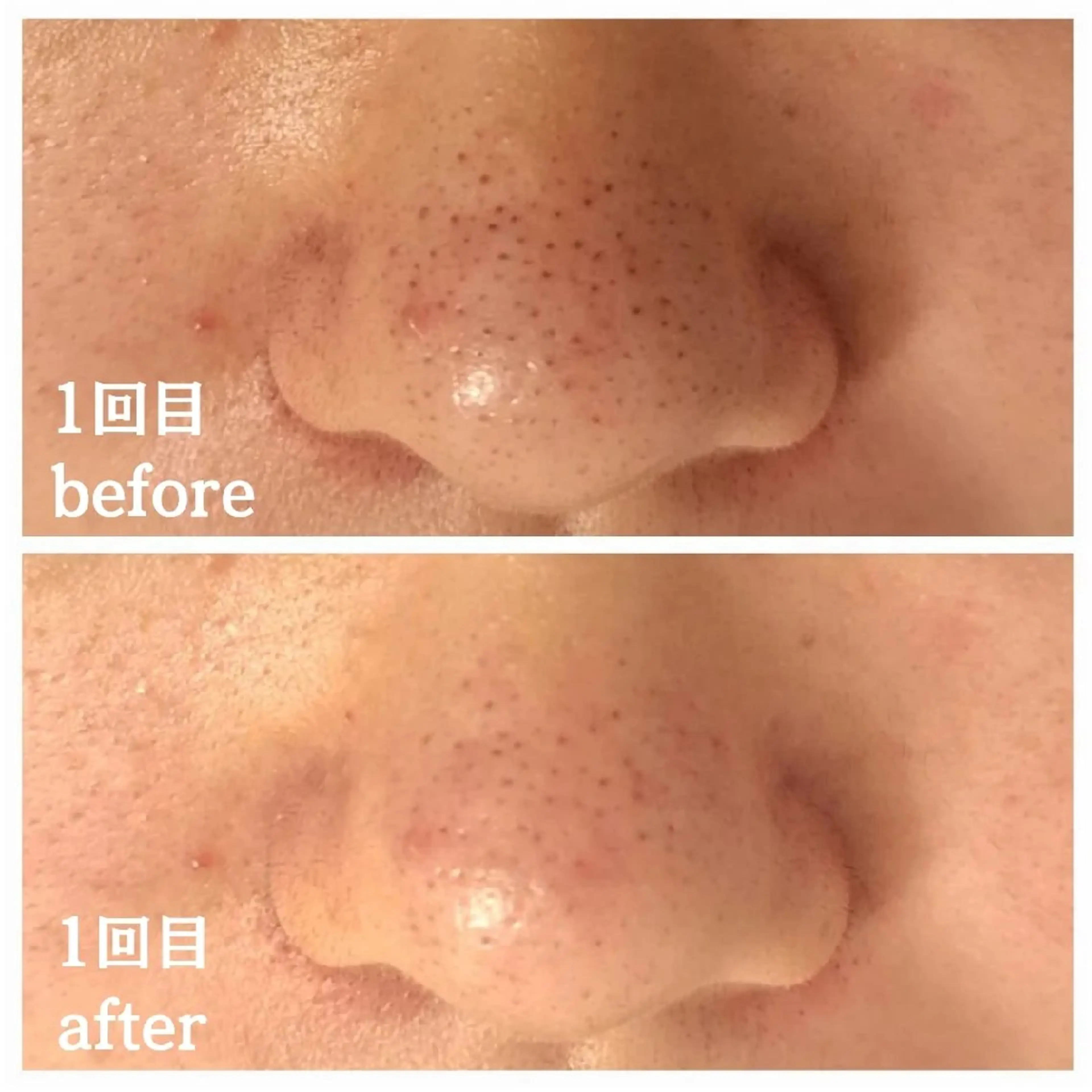 フェイシャル専門サロ ン　ERINのエステ・リラクイメージ