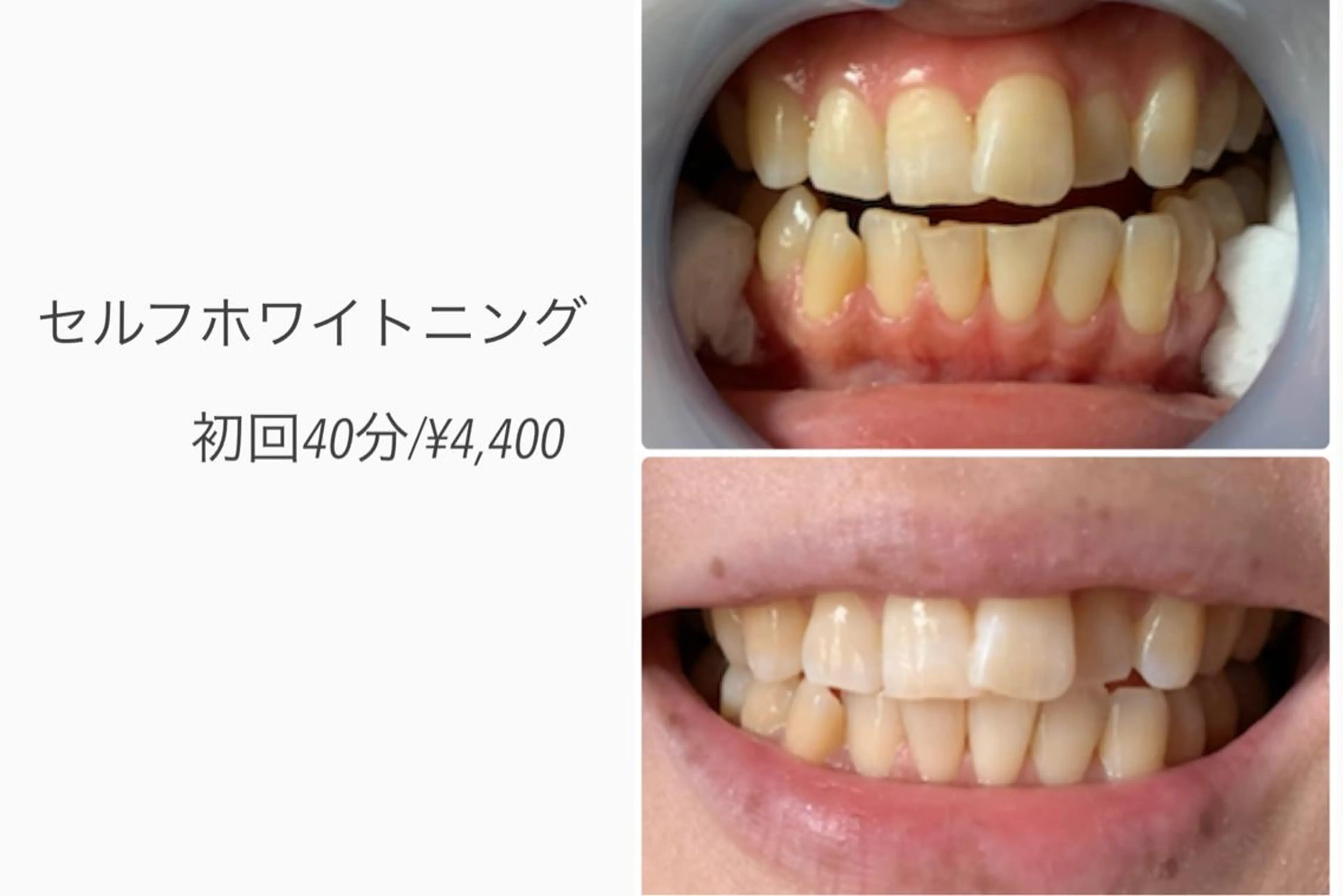 ベルフェリーチェ 早織のエステ・リラクイメージ