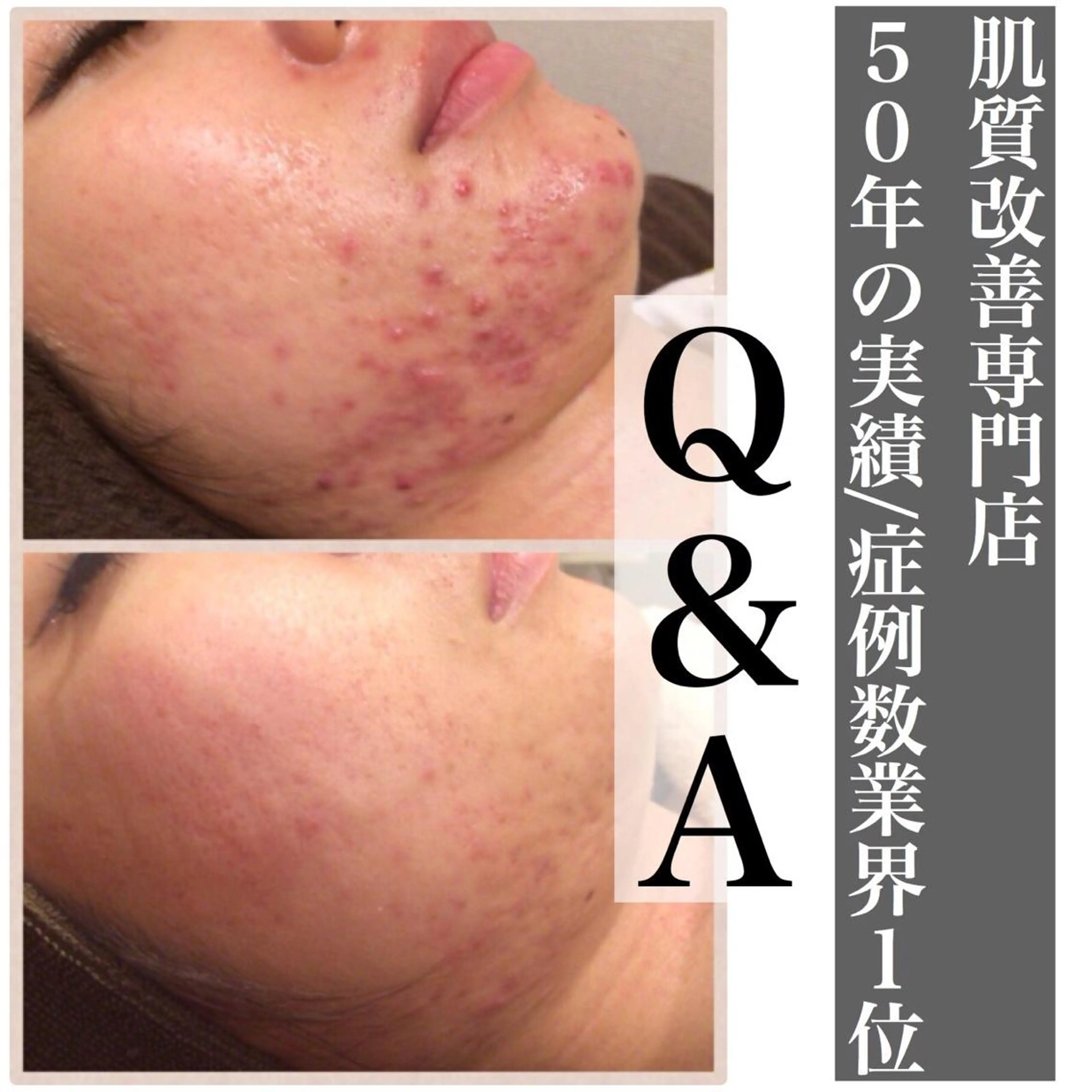 セミロング カラー パーマ ヘアアレンジ メンズ キッズ ネイル マツエク・マツパ エステ リラク ニキビ・肌質改善専門 ♡人生が変わるサロンのエステ・リラクイメージ