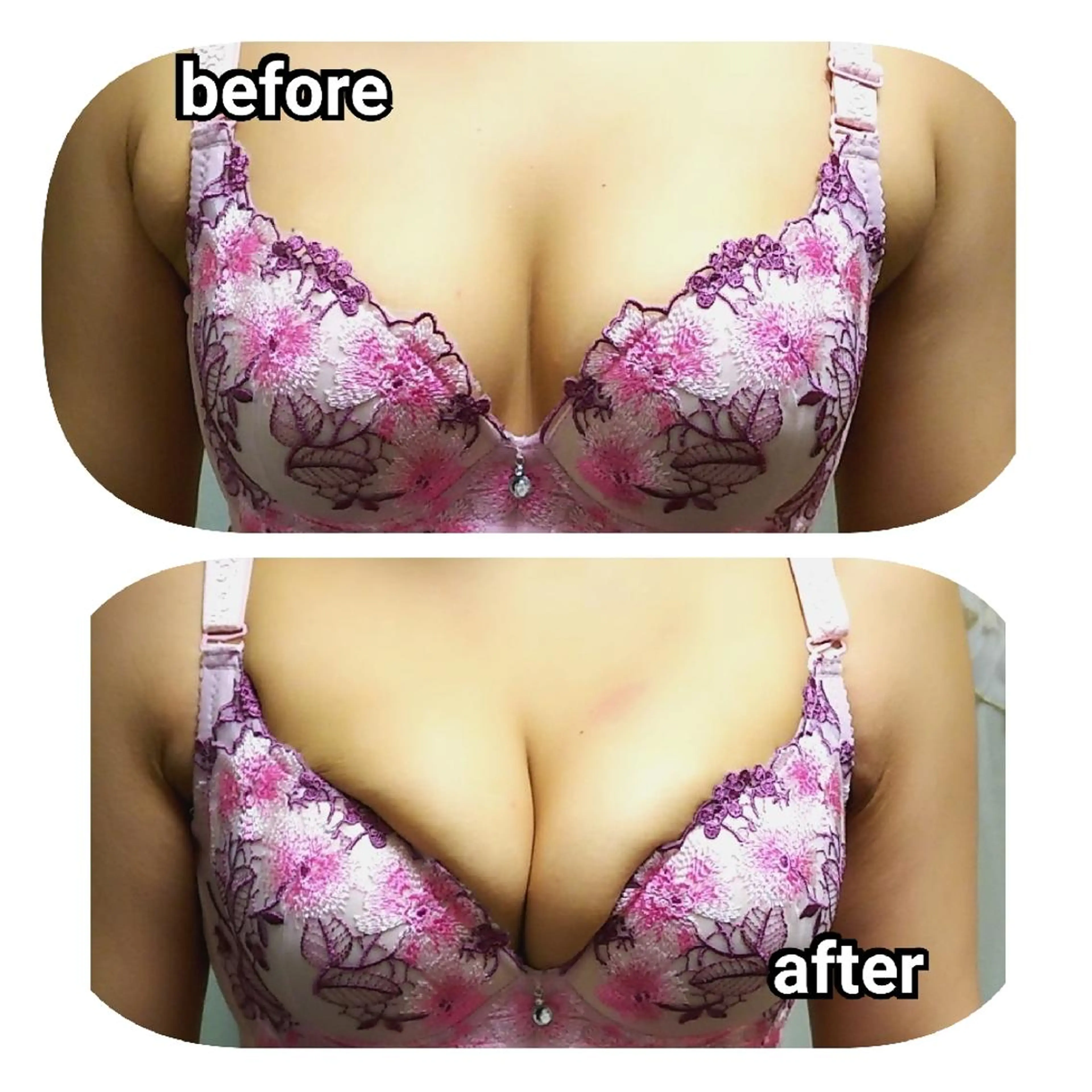 バスト&フェイシャル 専門店リラーシェのエステ・リラクイメージ