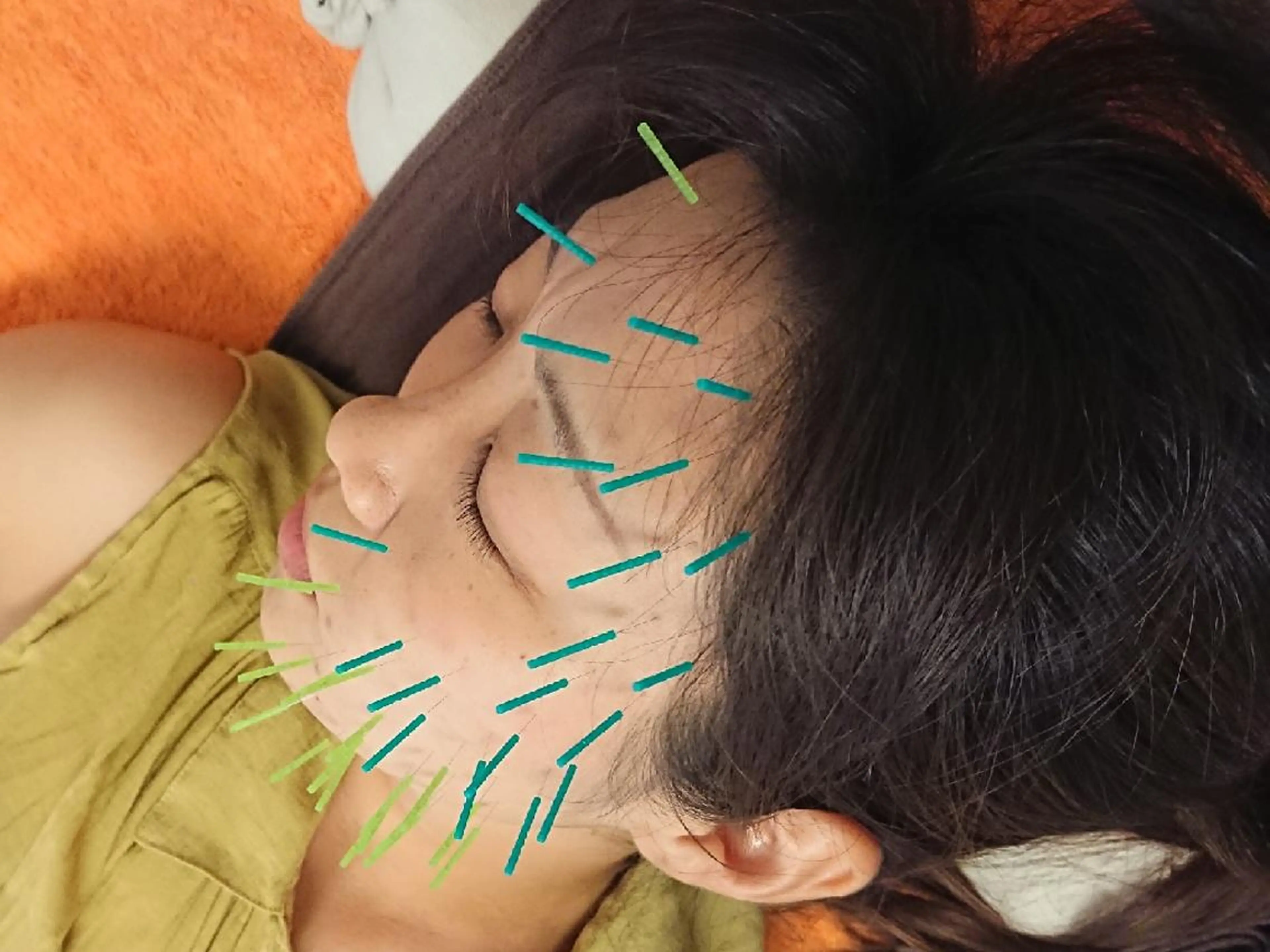 美容鍼マイスター 川村　淳のエステ・リラクイメージ