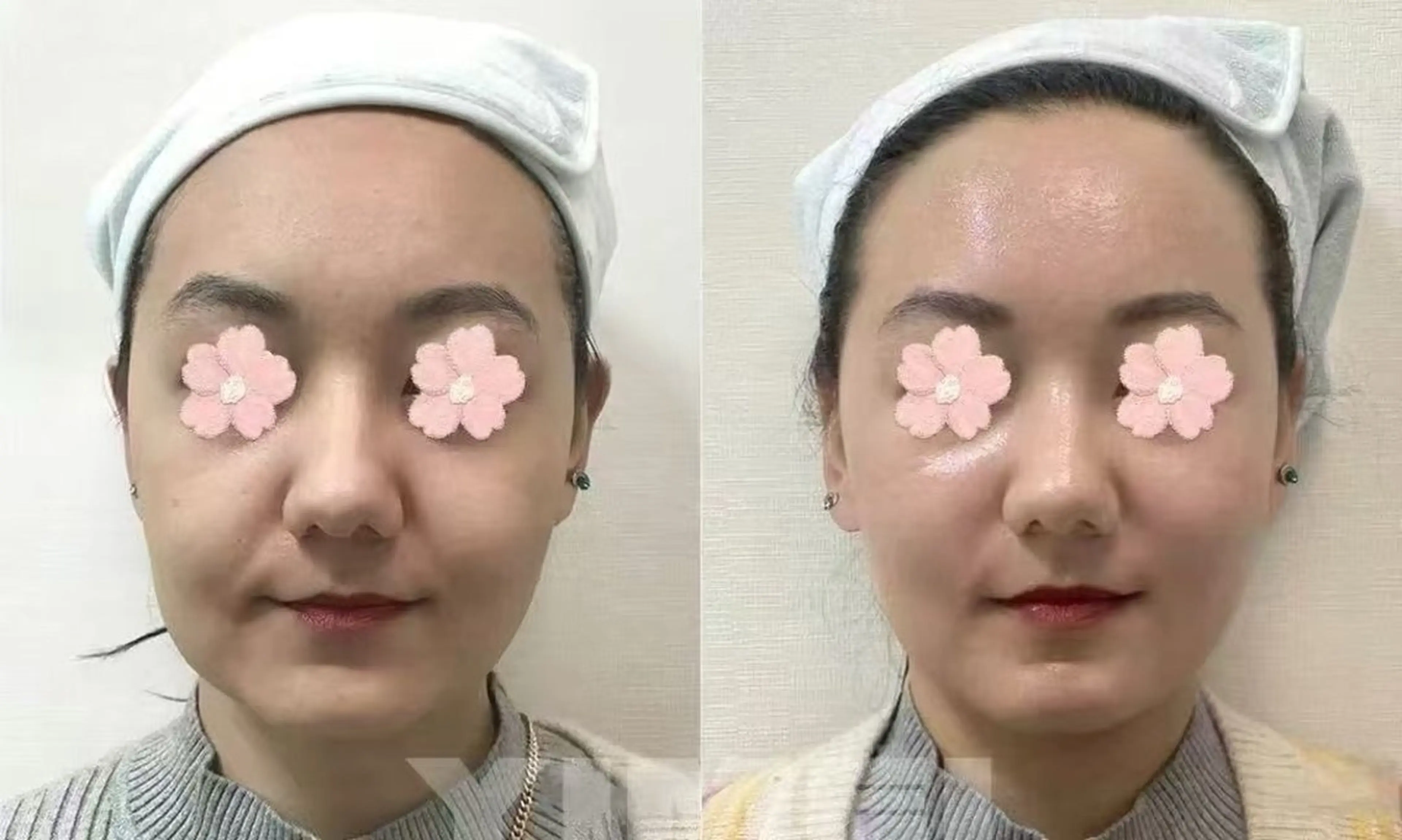 ネイル aliaハーブ水光店 エステティシャン募集のエステ・リラクイメージ