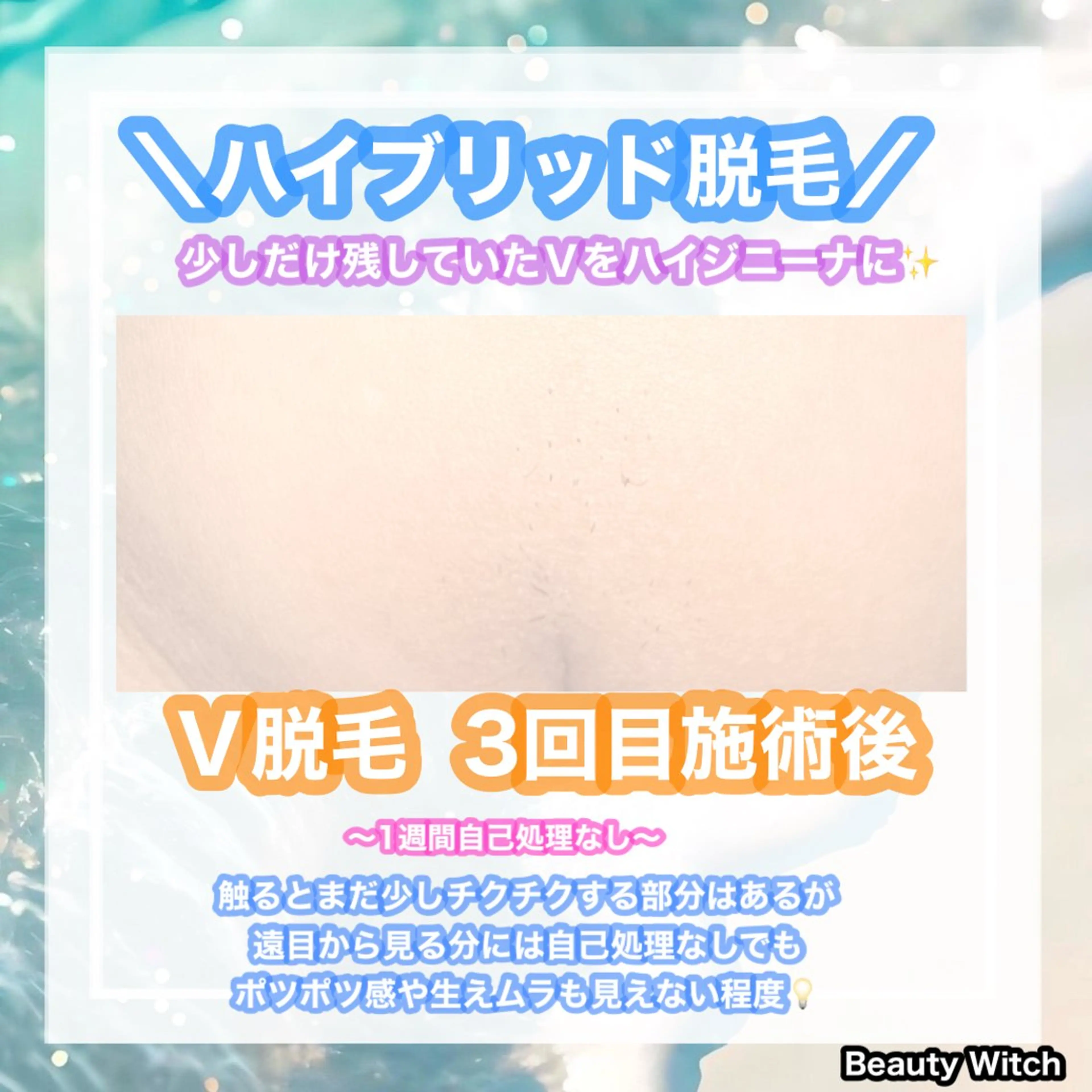 脱毛 痩身/脱毛/ネイル HARUKAのエステ・リラクイメージ