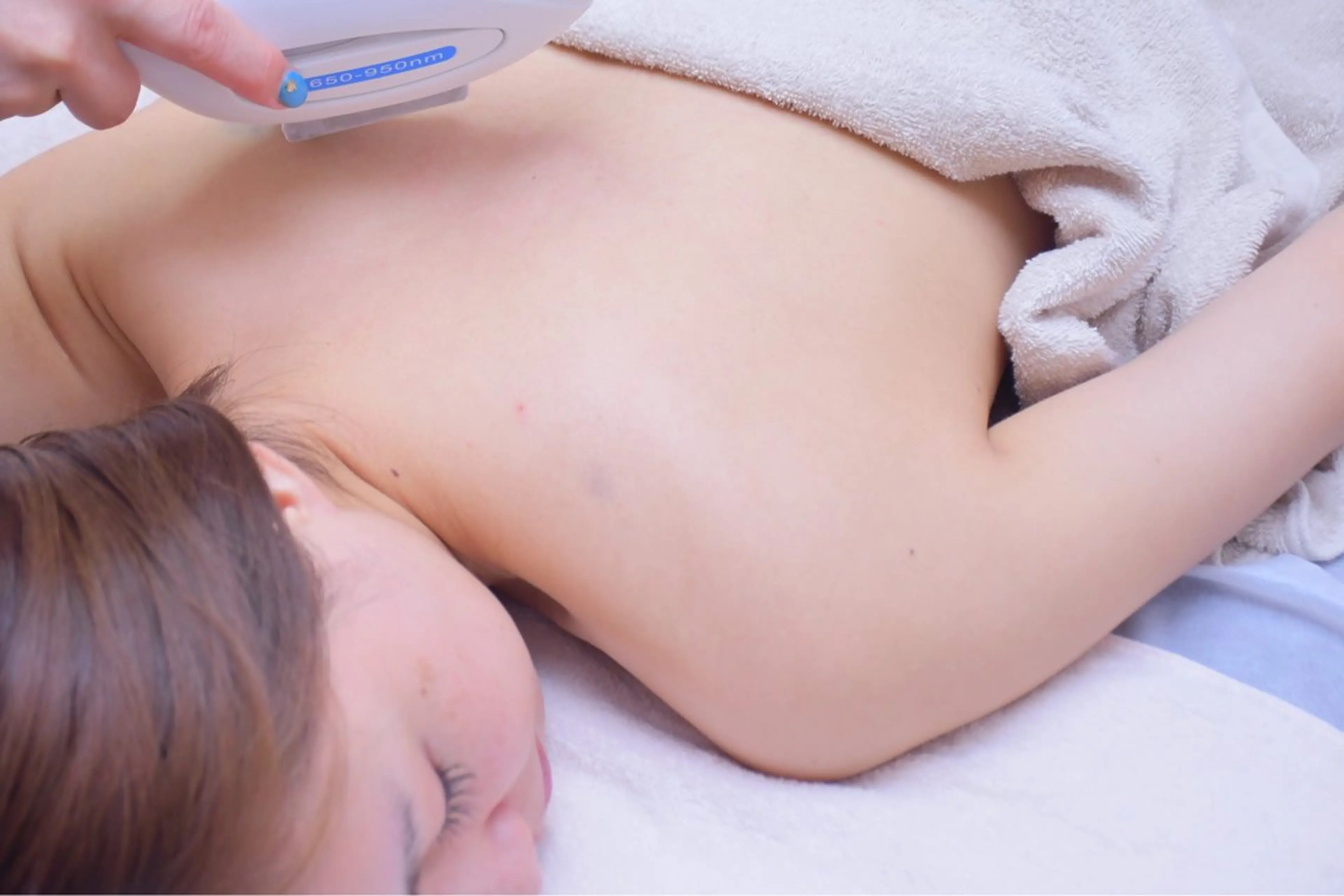 【女性限定】うなじ＋背中美肌脱毛の写真