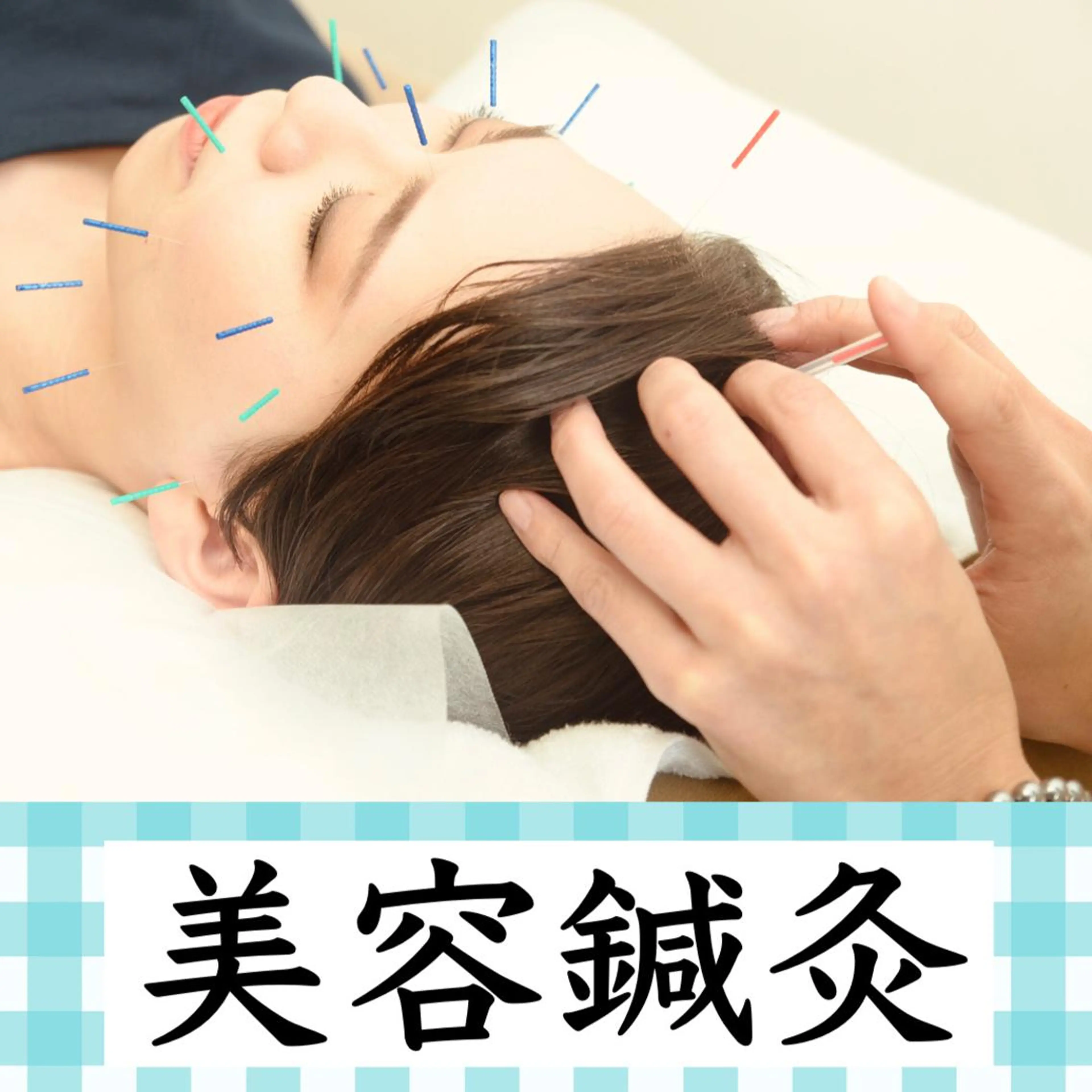 ☆お顔の肌を整えたい☆ 美顔鍼+小顔矯正+リンパマッサージ+ドライベッドスパ(ご希望の施術をお選び頂けます。複数可)の写真